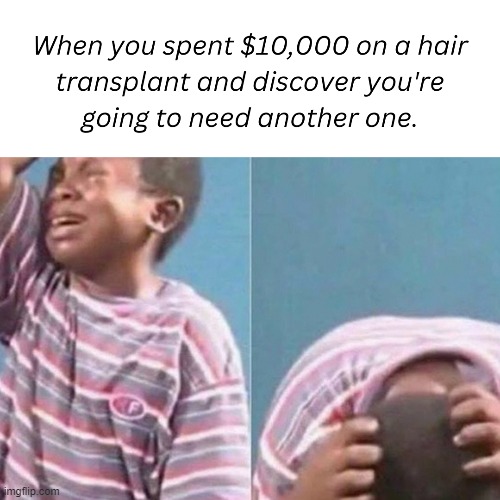 funny hair transplant meme Imgflip