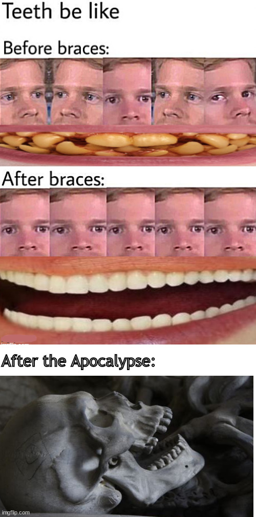 teeth be like Imgflip