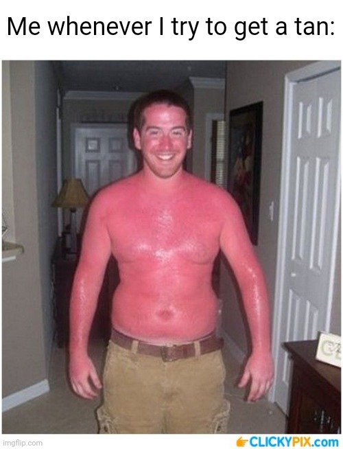 Funny Sunburn Meme