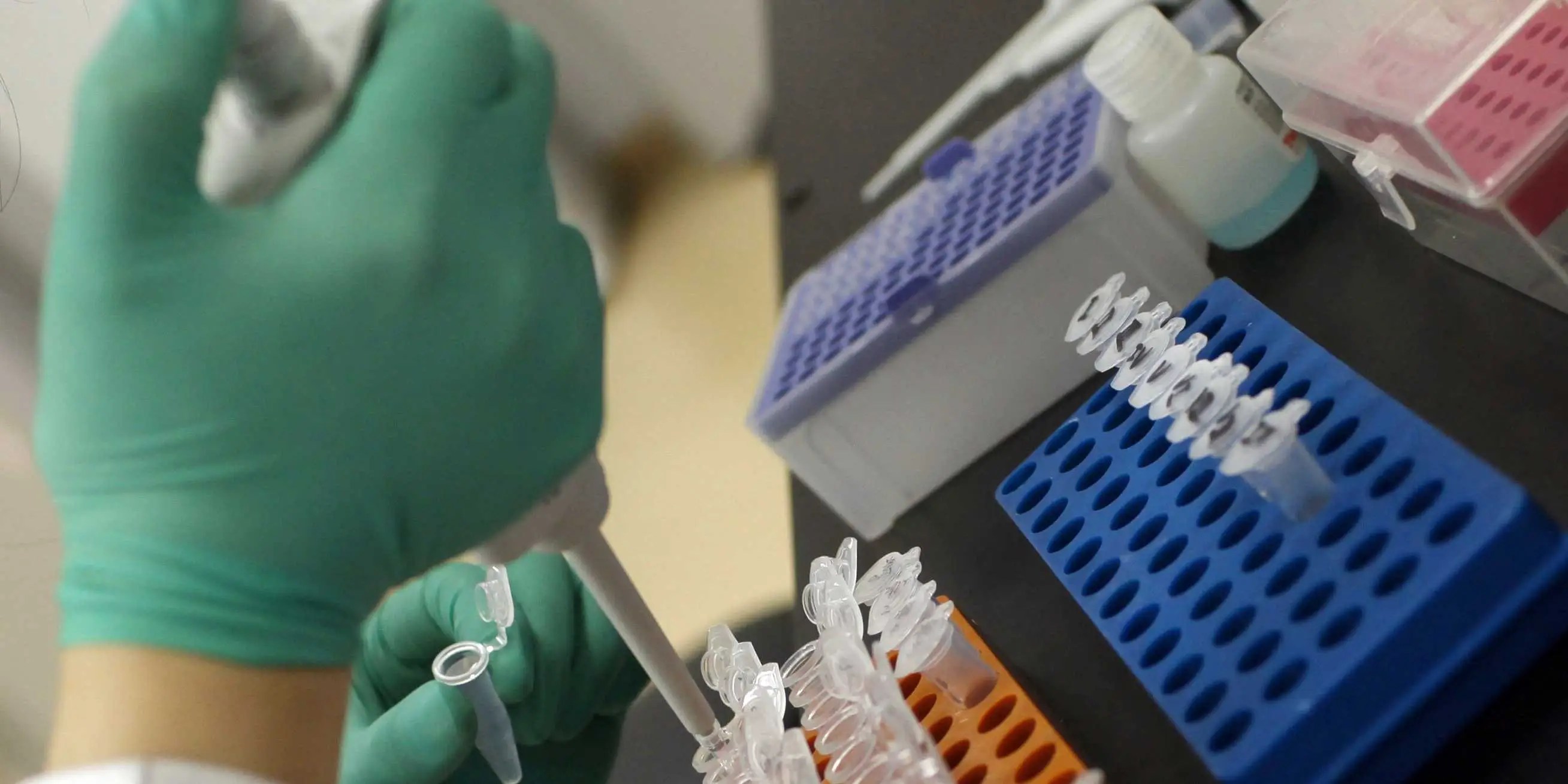 LabCorp Acquires Chiltern M&A in Contract Research Organizations