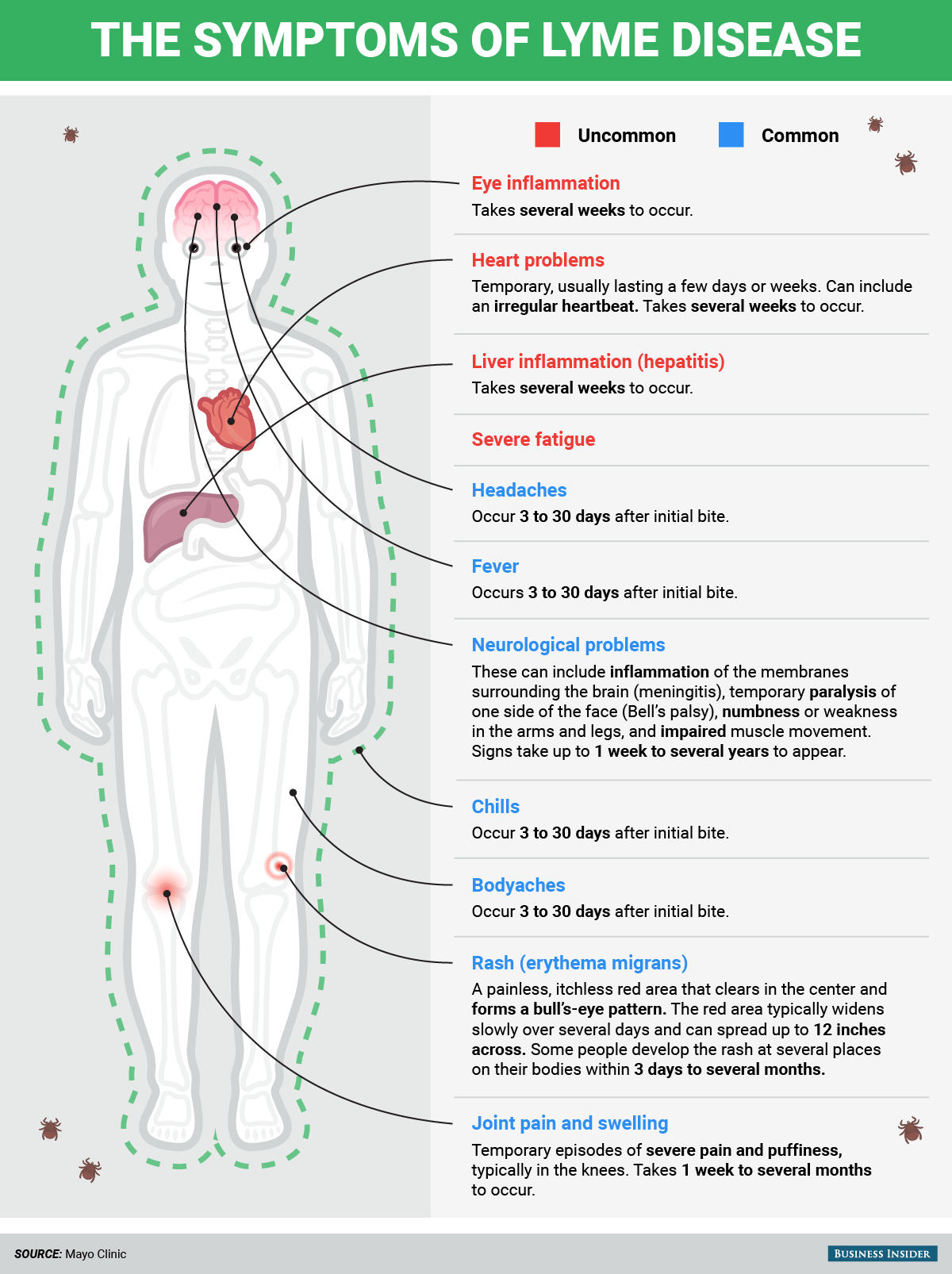 Lyme Disease Symptoms