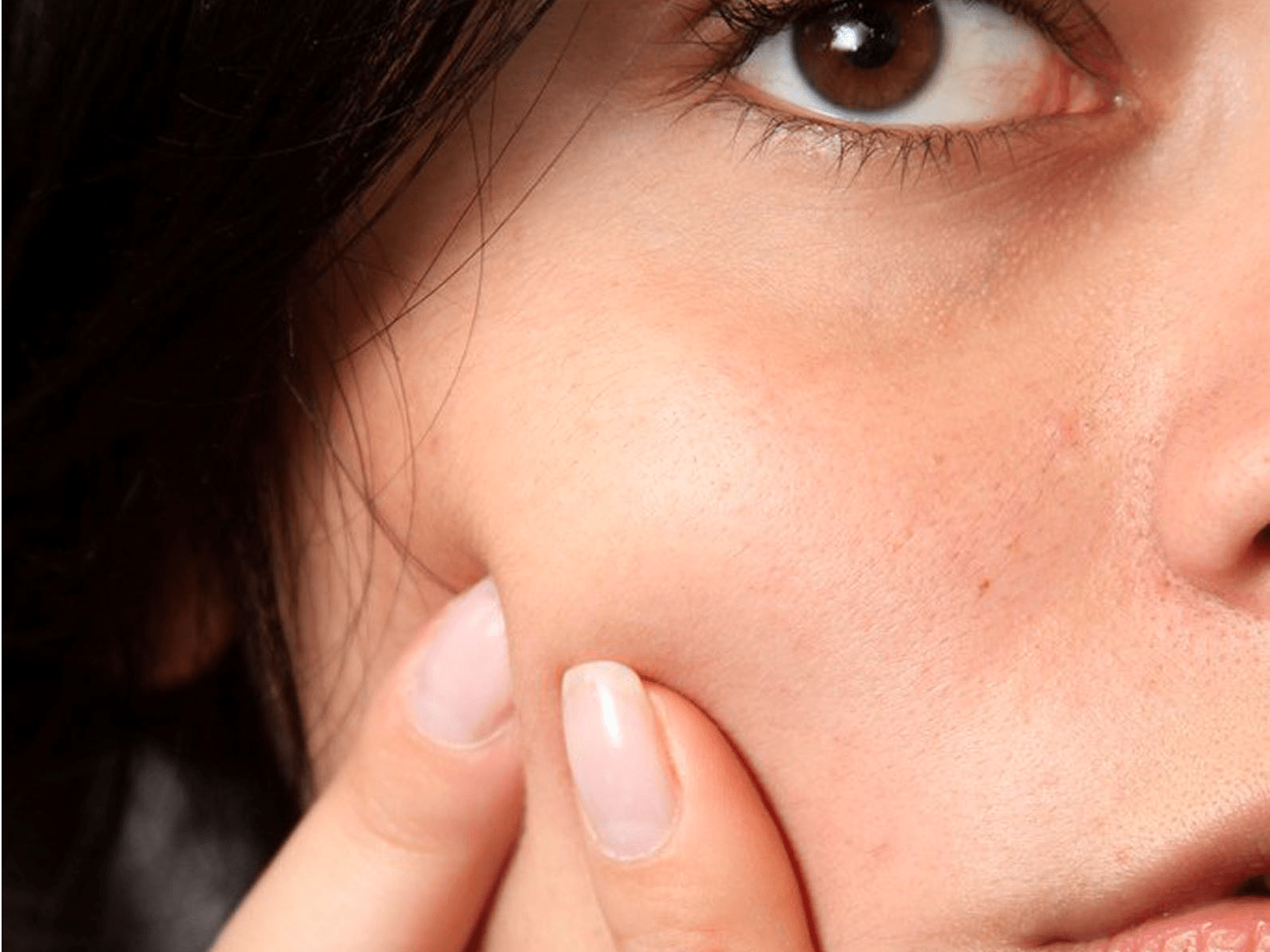 FAZIYAN】Quickly Pimple Remover Cream Acne Repair Cream Fades Acne Marks