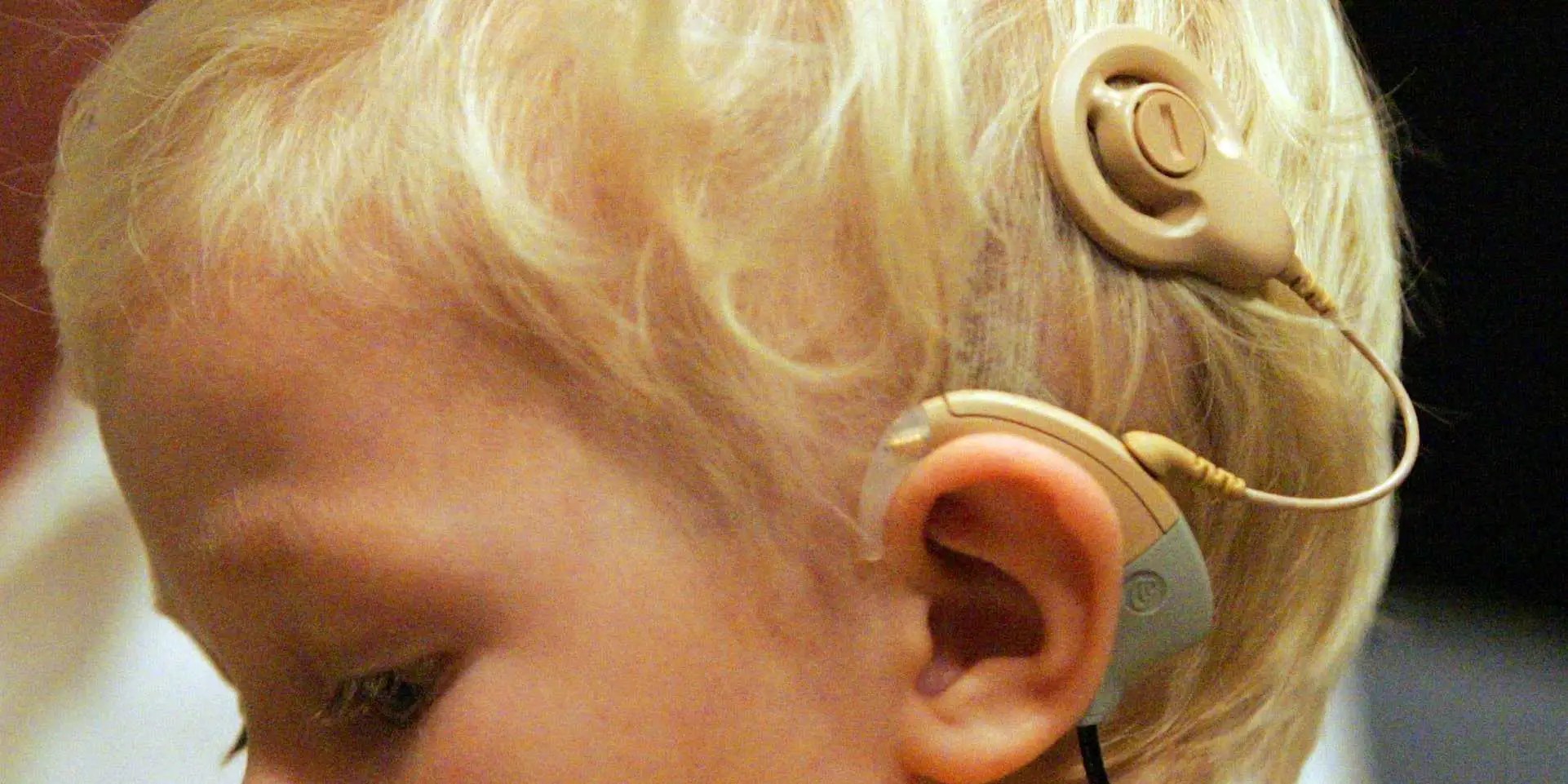 Why deaf people turn down cochlear implants Business Insider