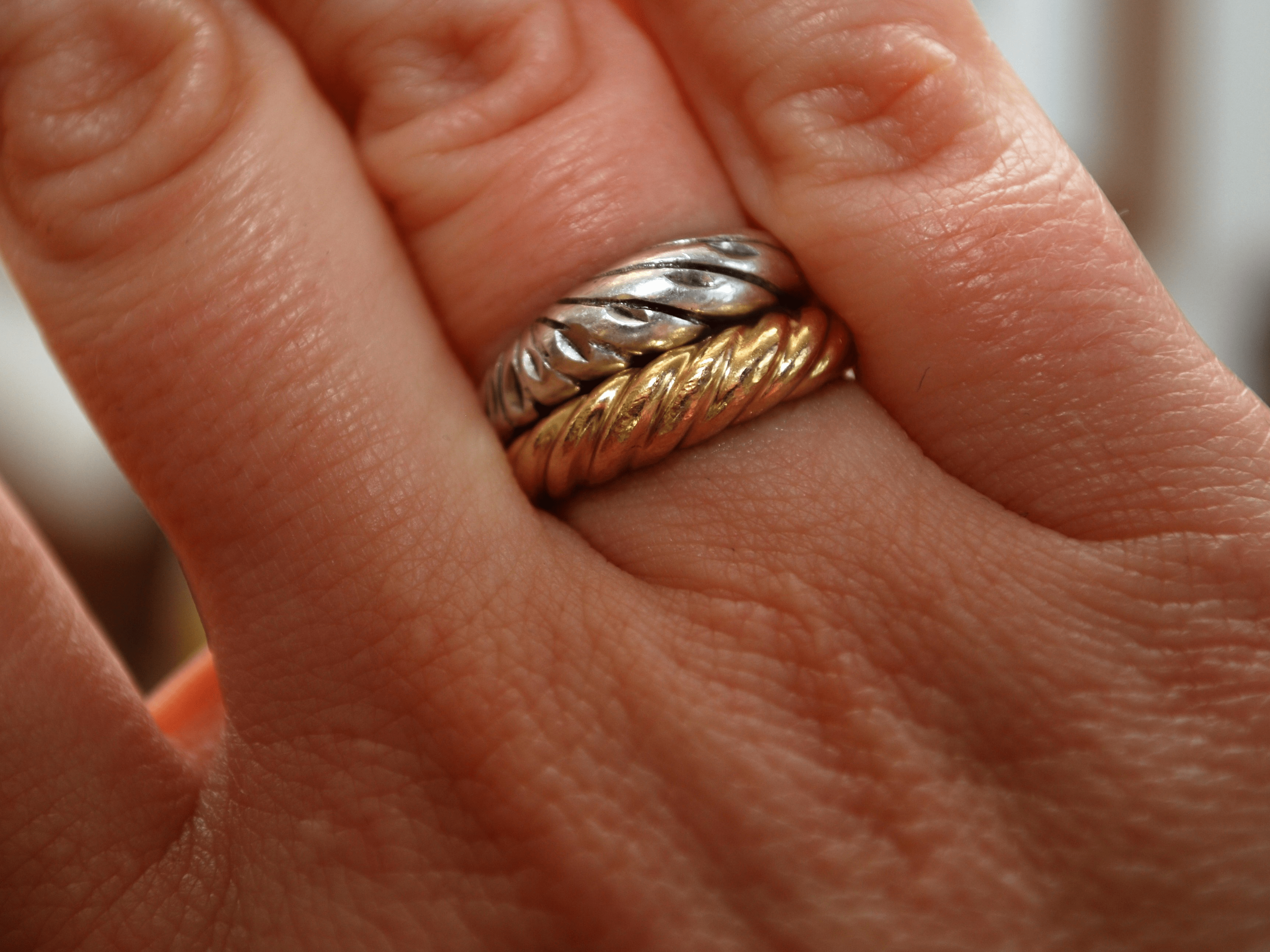 Why Some Jewelry Turns Your Skin Green—And How To Prevent It