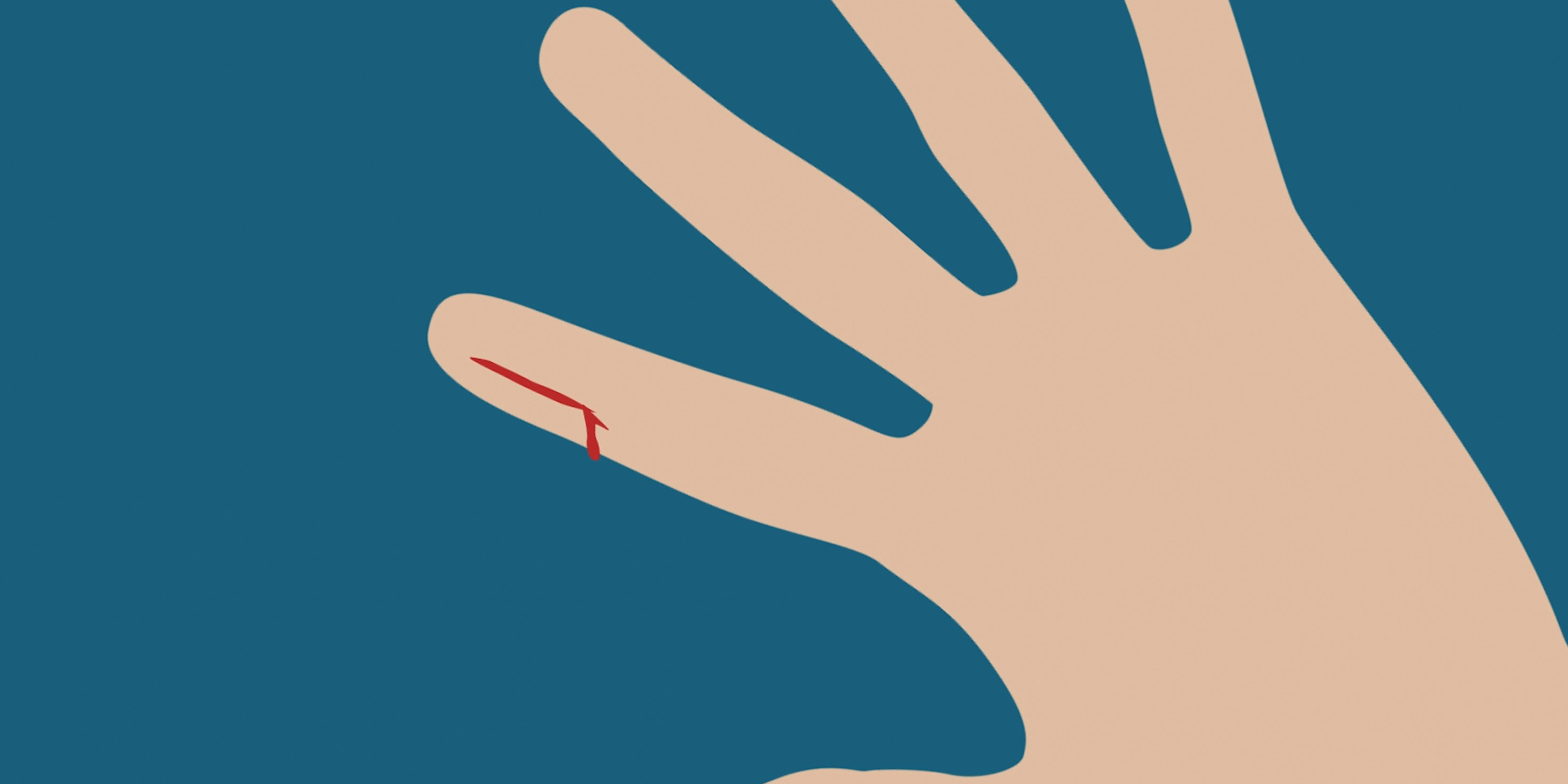 Why Do Paper Cuts Hurt? Business Insider