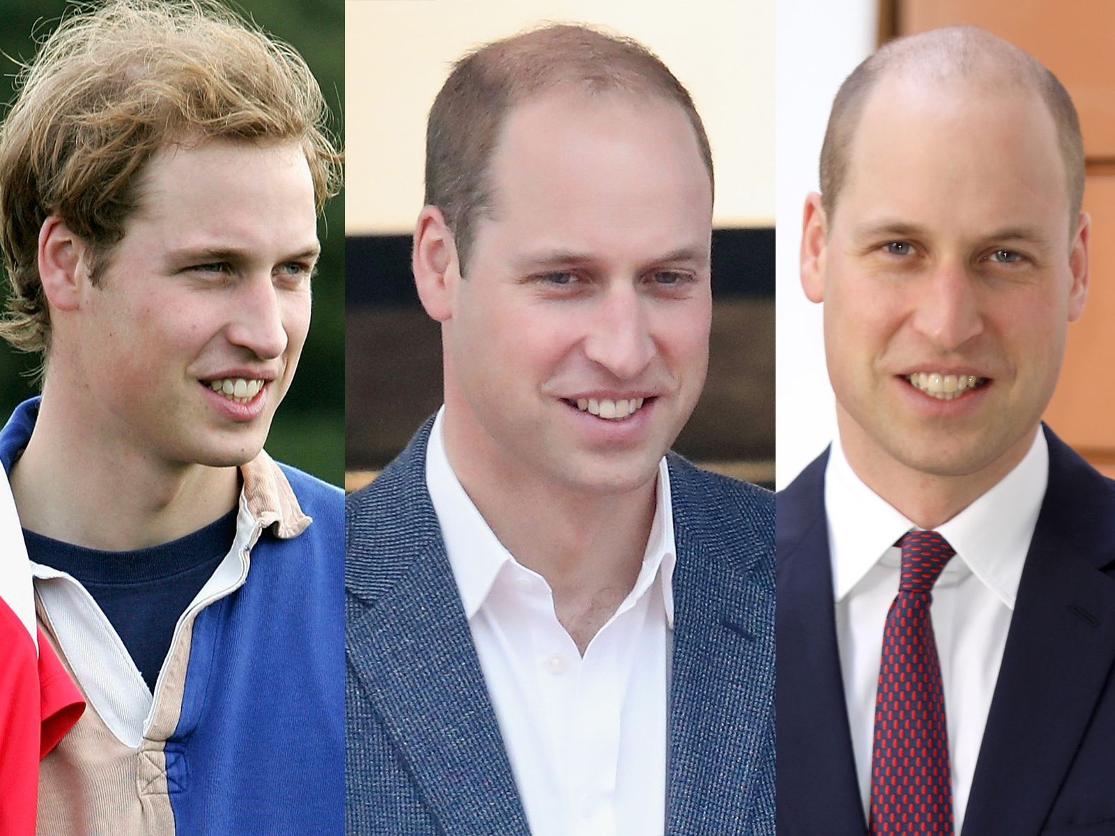 It Was Time for Prince William to Finally Shave His Balding Head