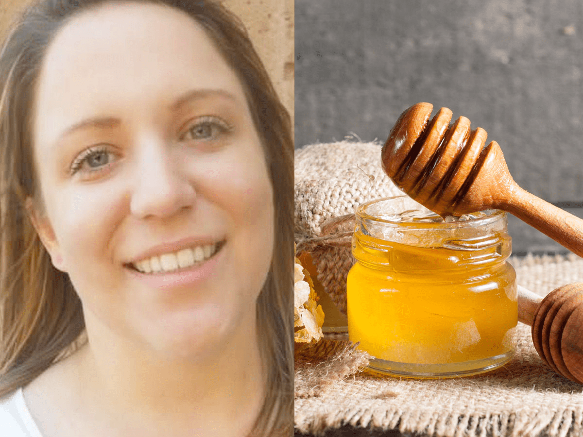 Raw Honey For Acne Before And After