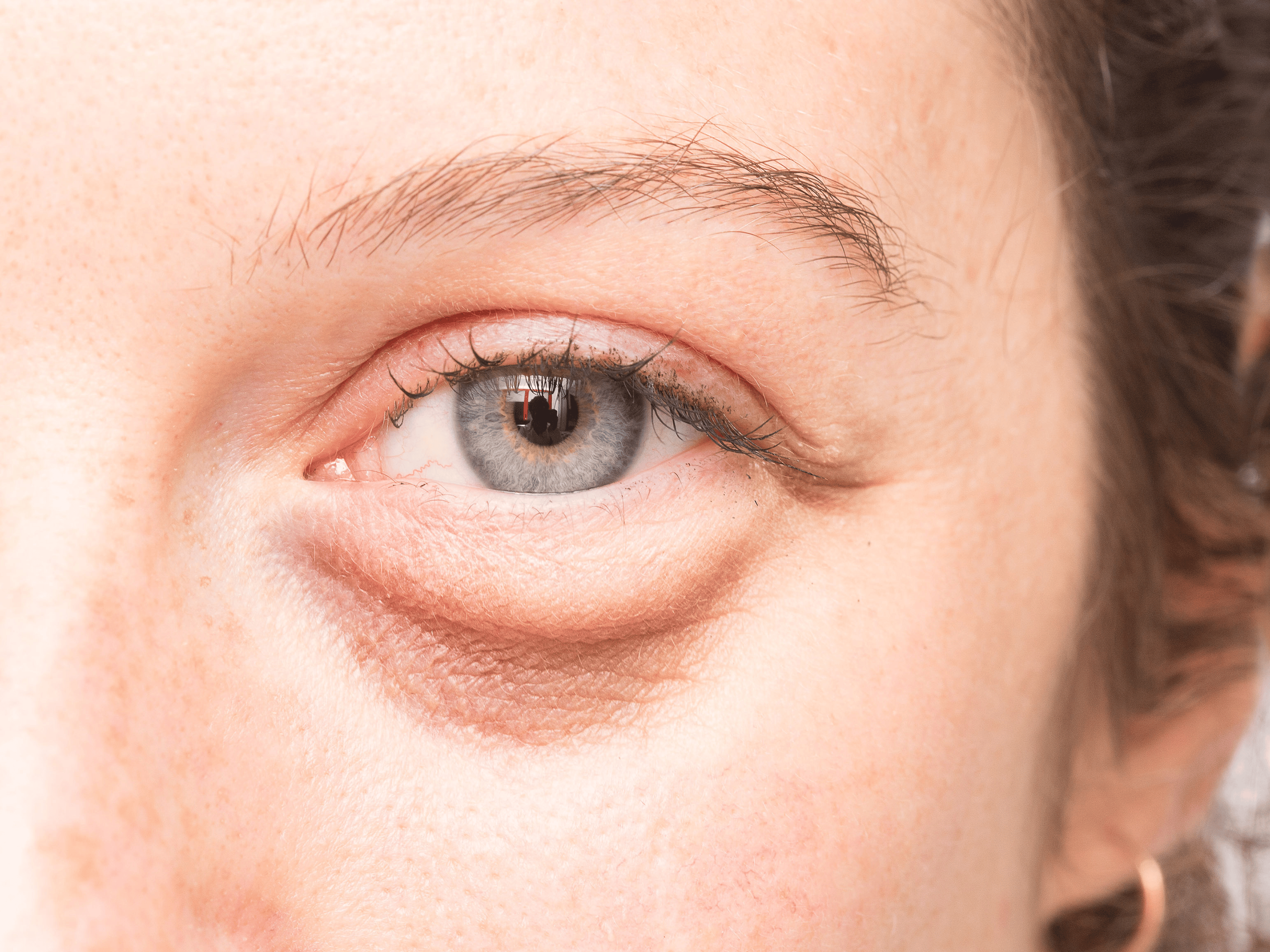 Surprising Signs of Dehydration