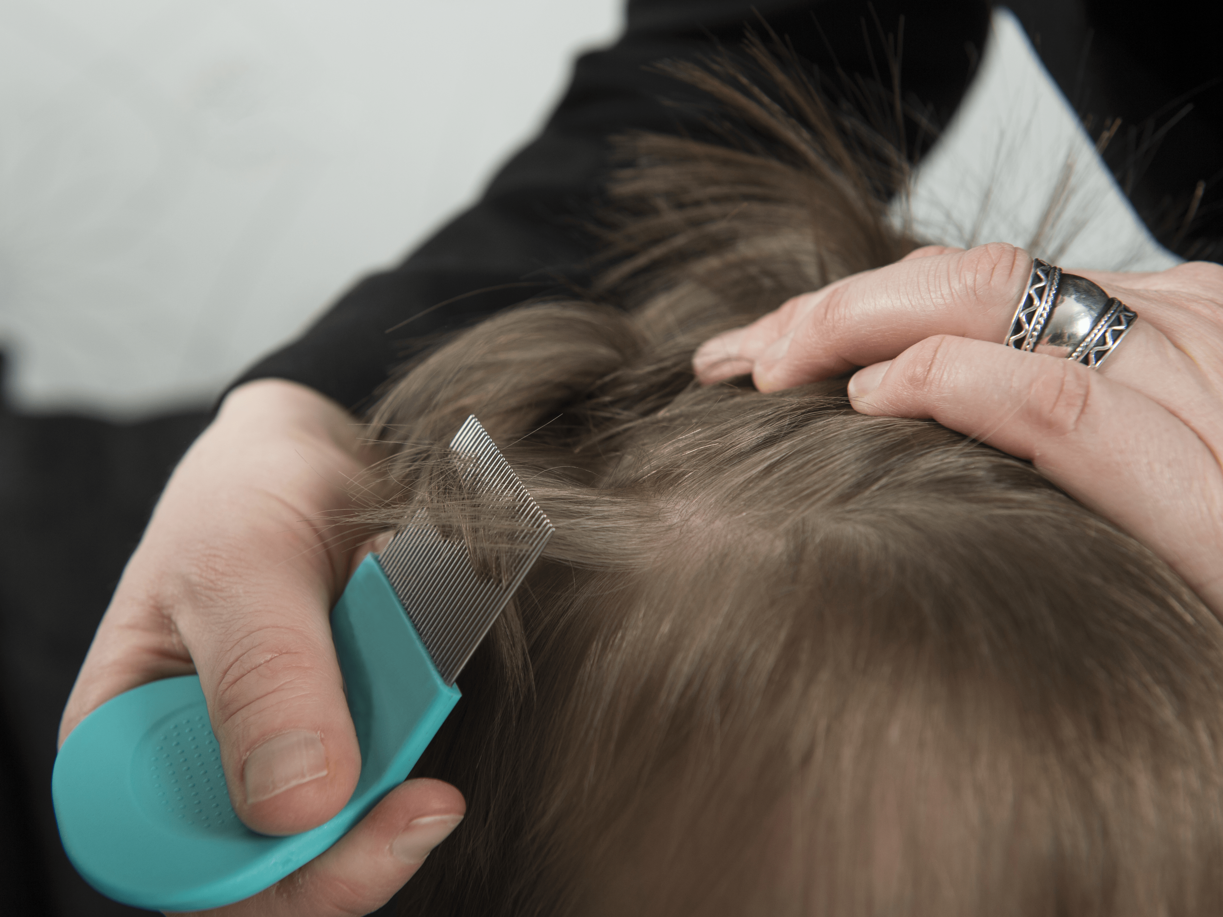 How To Check For Head Lice Fatintroduction28