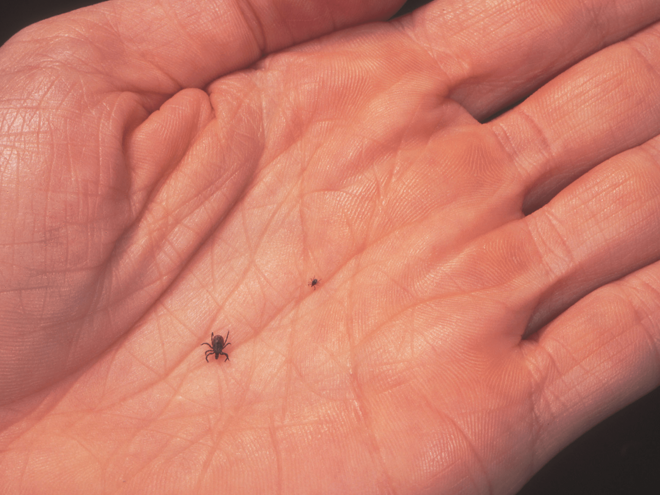 Lyme Disease Here's What You Need to Know Business Insider