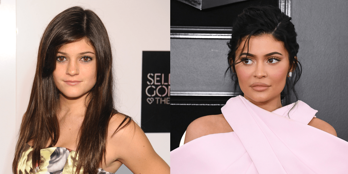 Kylie Jenner Denies Plastic Surgery but Credits 'Fillers' for Her Look