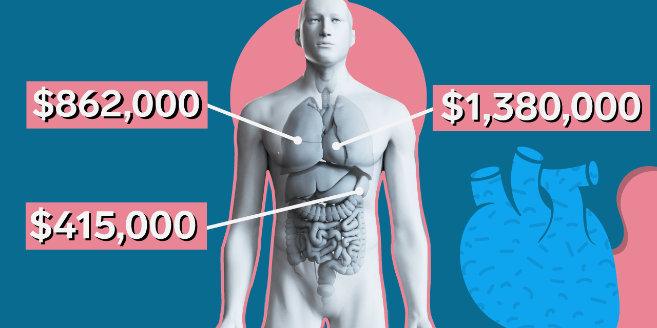 Why Organ Transplants Are so Expensive in the United States Business