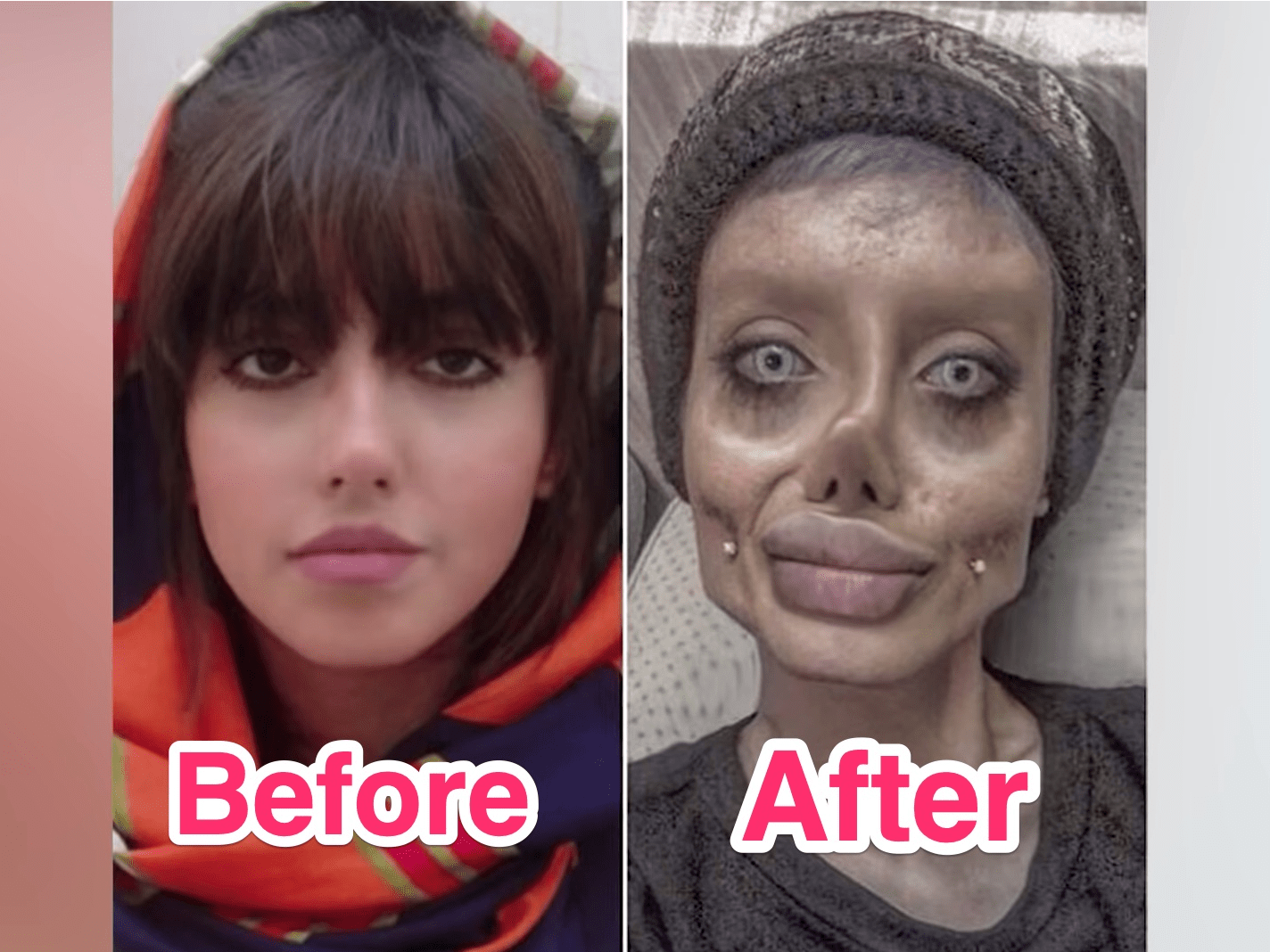 Iran Influencer Who Underwent Dozens of Cosmetic Surgeries Arrested