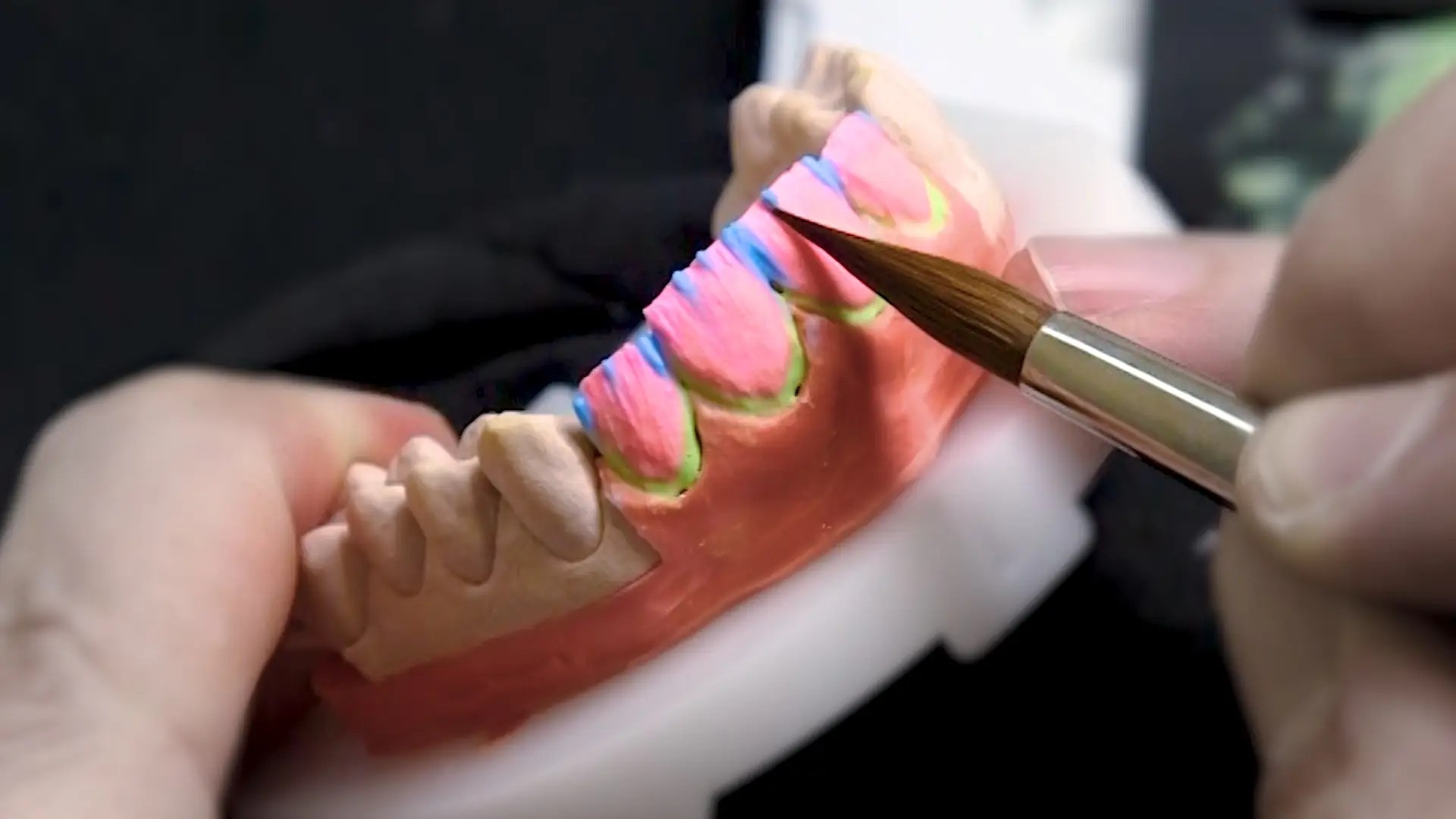 TV Host's Exhaustion, Numbness Result of Undiagnosed Thyroid Condition