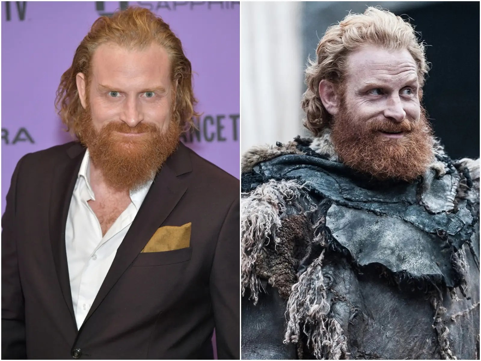 Game Of Thrones' Star Kristofer Hivju Tests Positive For The Coronavirus