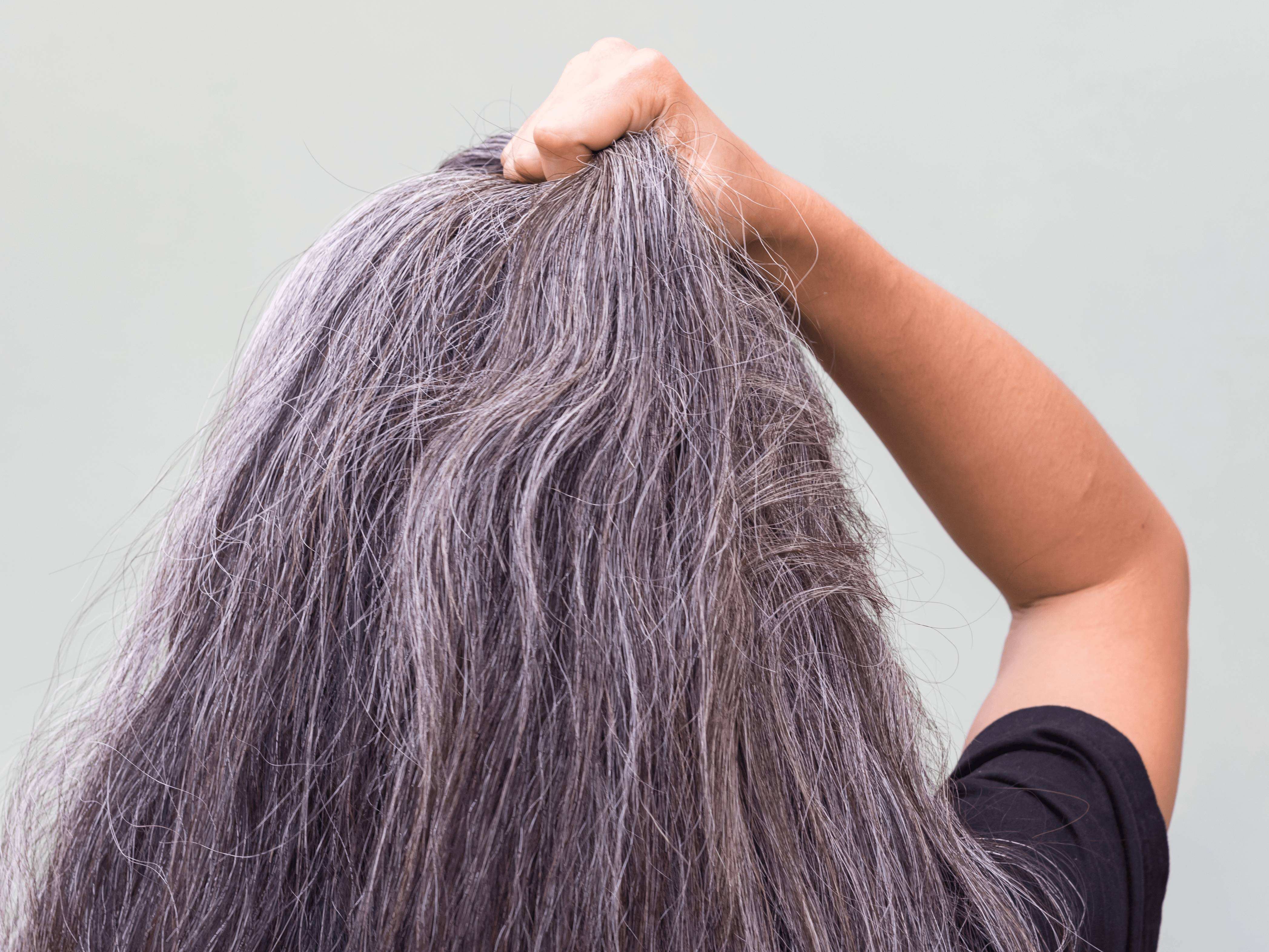 Does stress cause grey hair? It may lead to premature graying