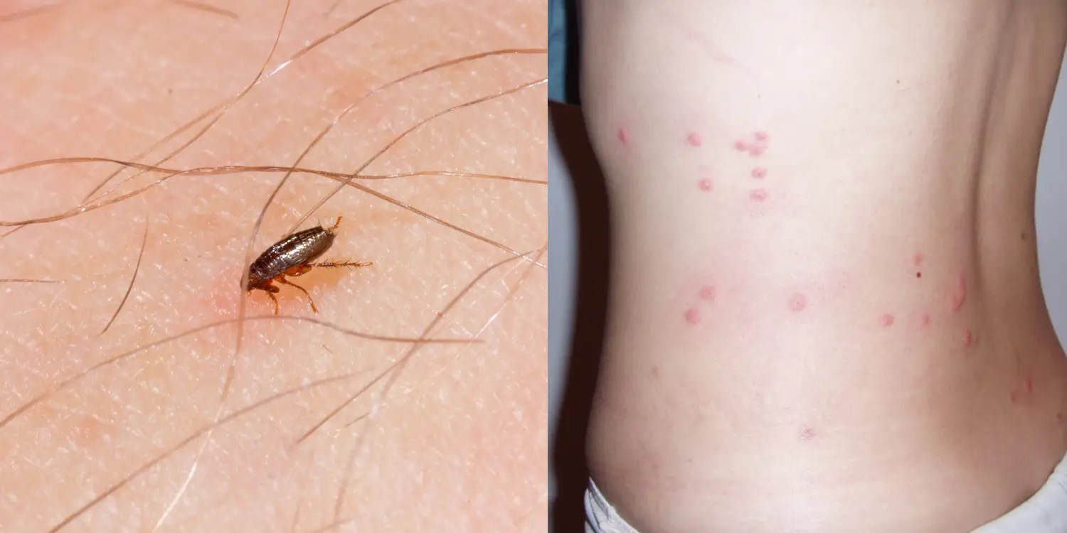 Do Flea Bites Look Like Pimples On Dogs