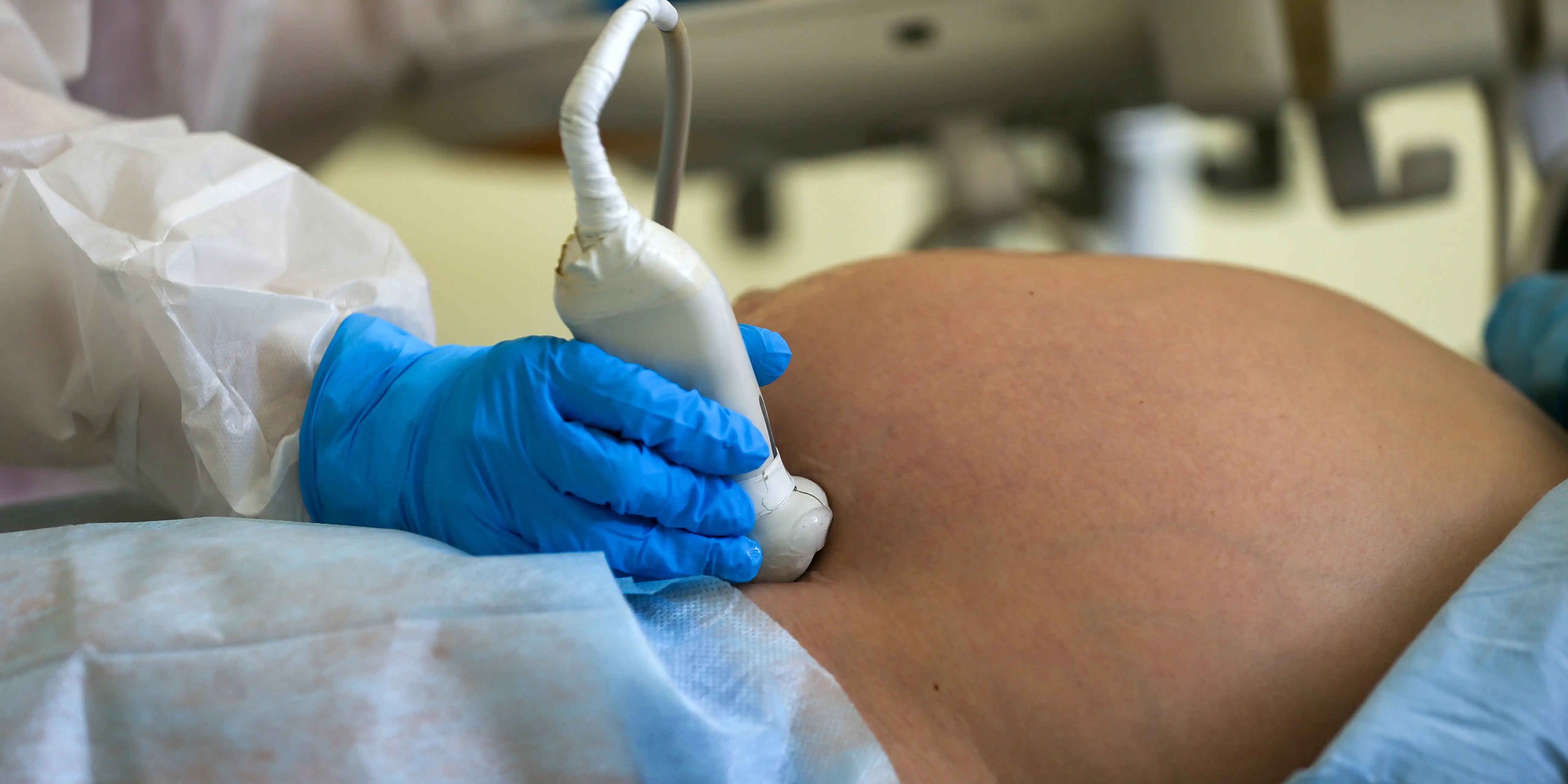 Ectopic pregnancy Symptoms, risk factors, and treatment