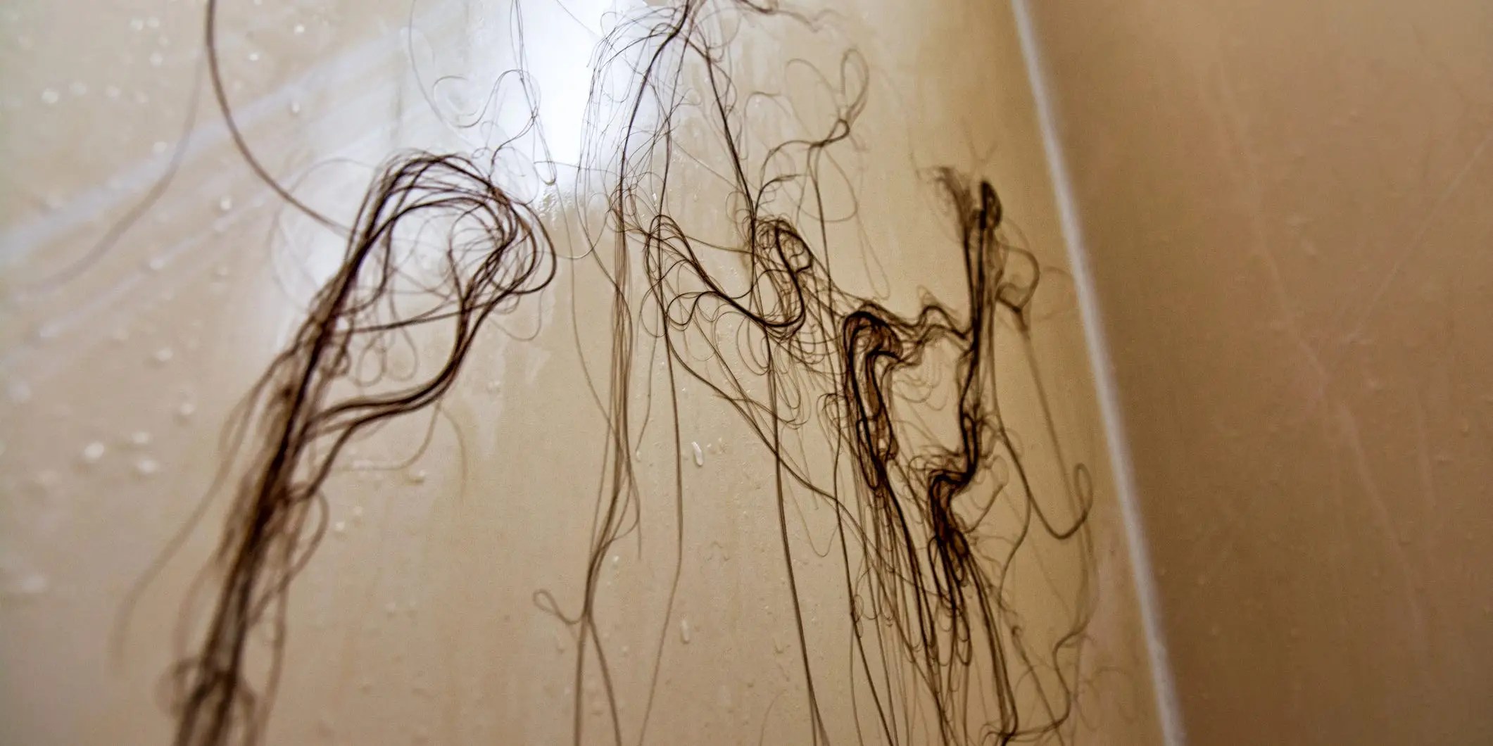 Why Is My Hair Falling Out? 5 Reasons for Shedding Zipe