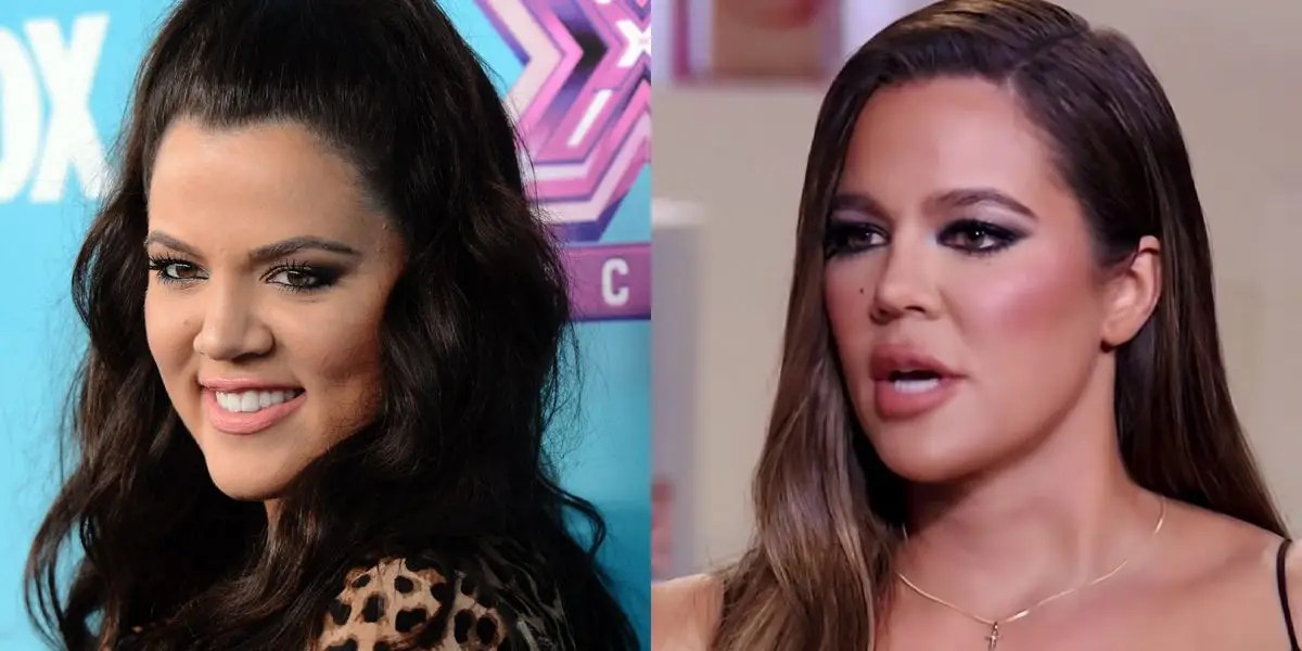 Khloe Kardashian Confirms She's Had 'One Nose Job' and Injections