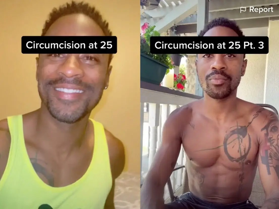 A 25YearOld Got Circumcised After Phimosis Diagnosis, Foreskin Pain