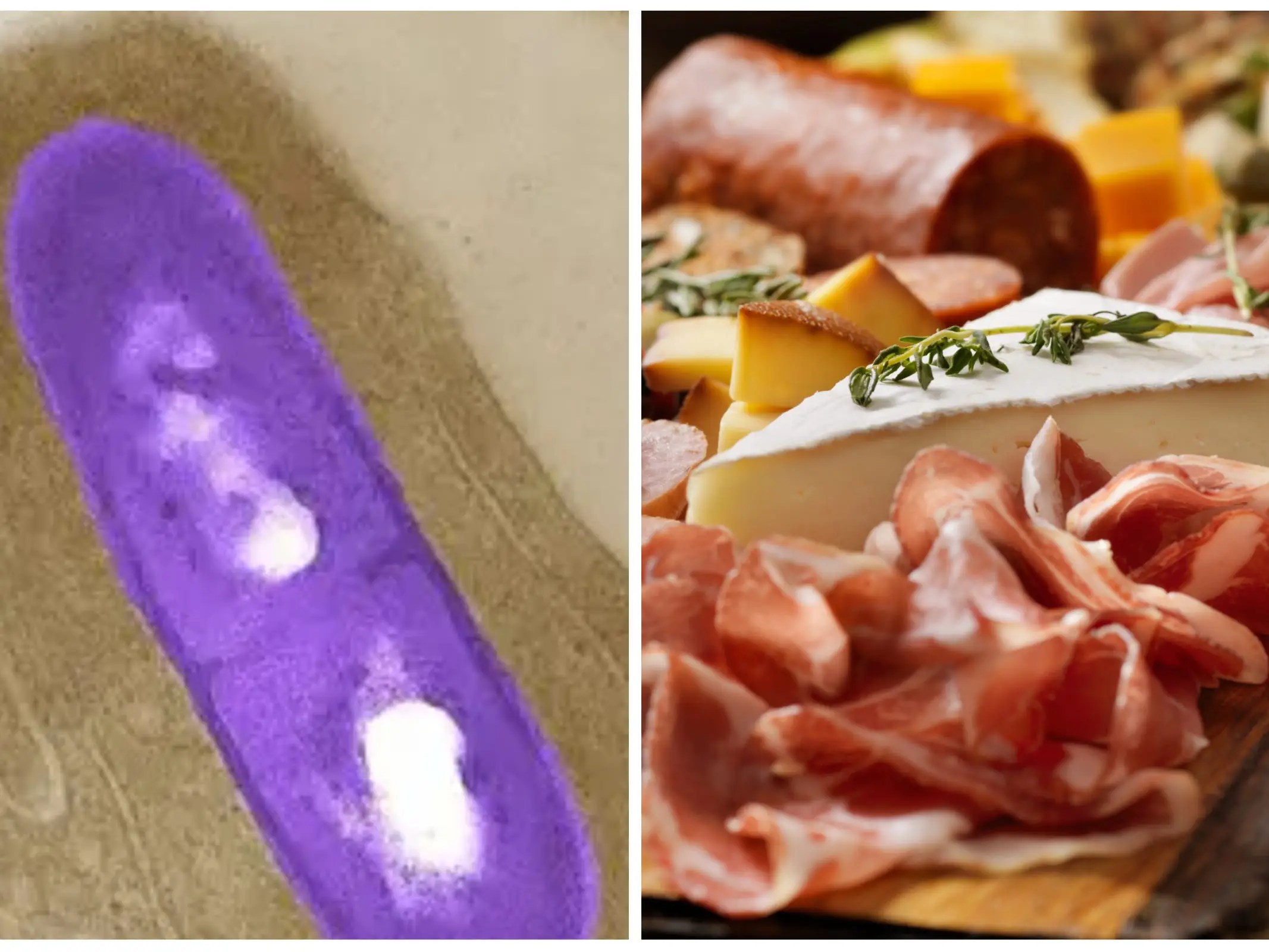 Deli Meat, Cheese Linked to Deadly Listeria Outbreak Symptoms
