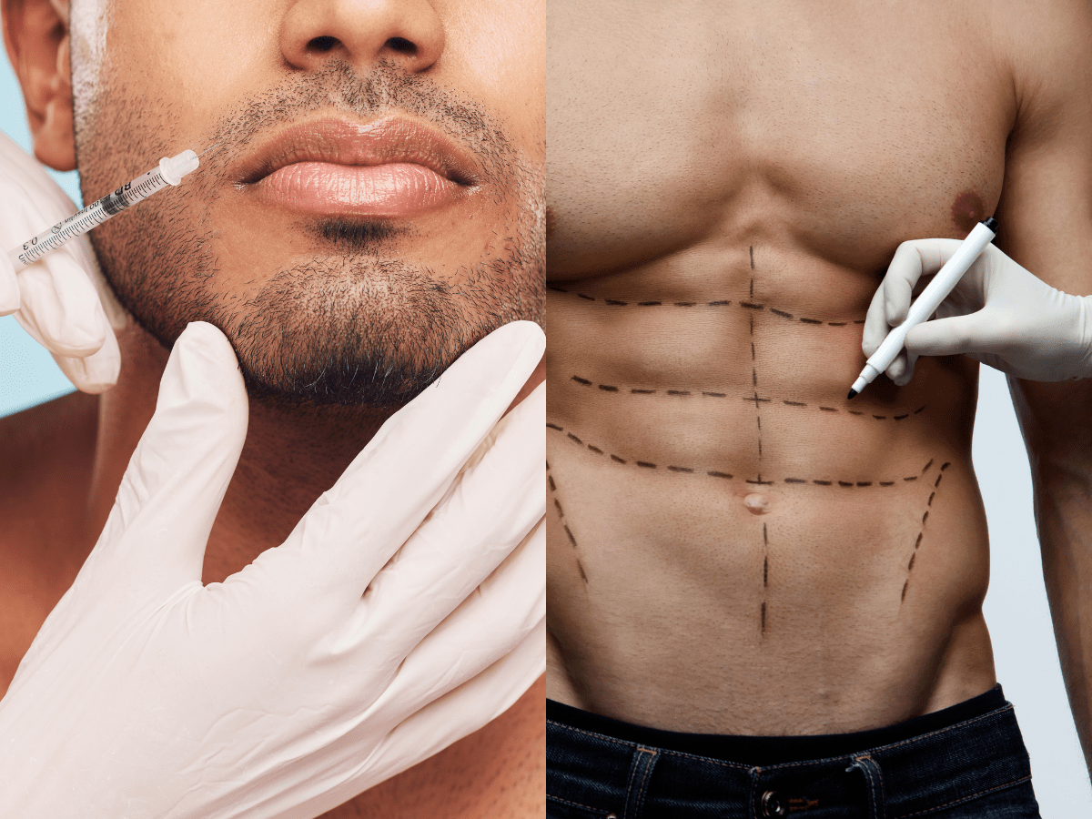 Miami Surgeon Reveals Top Plastic Surgery Trends for Men Business Insider