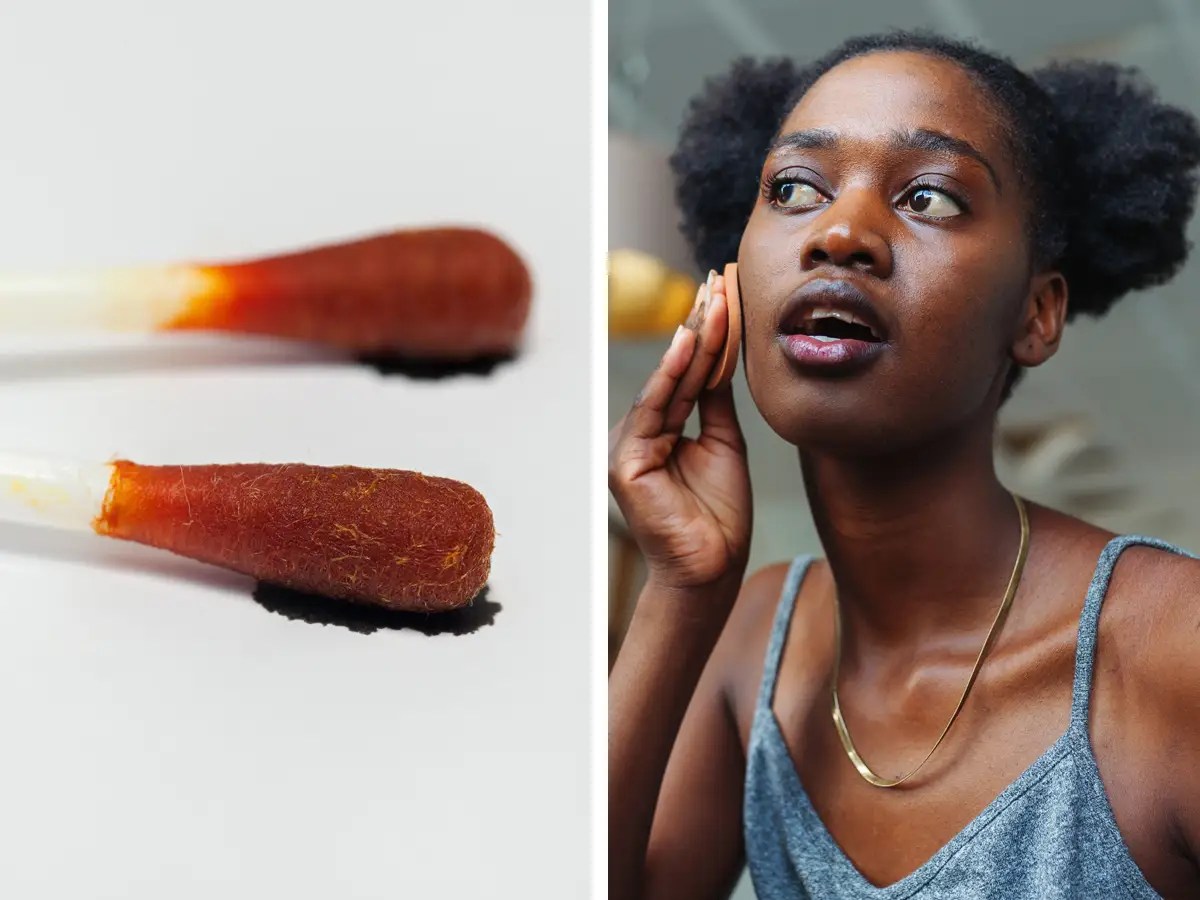 Using Iodine to Shrink Pimples Can Lead to More LongTerm Skin Problems