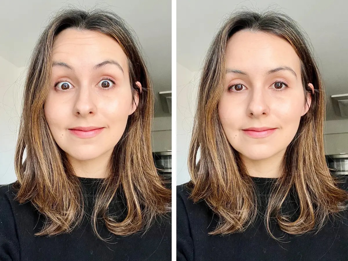 Botox Gone Wrong Before And After Botox For Men With Before And