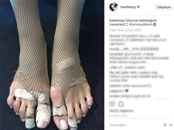 Hande Erçel'in ayak parmağı olay oldu!