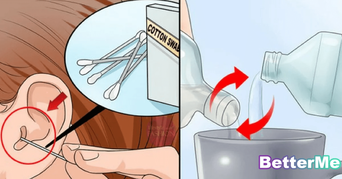 2Ingredient Mixture To EFFECTIVELY Eliminate Earwax