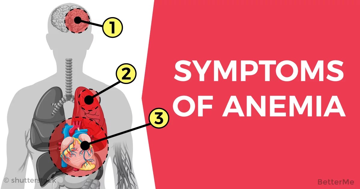 Don't ignore these symptoms, they might be caused by anemia