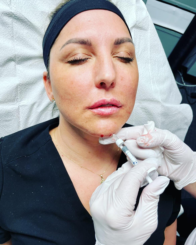 Elite Aesthetics Med Spa Review Overland Park Kansas