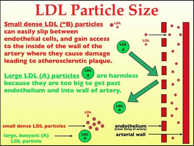 Cholesterol - LDL Particle Size