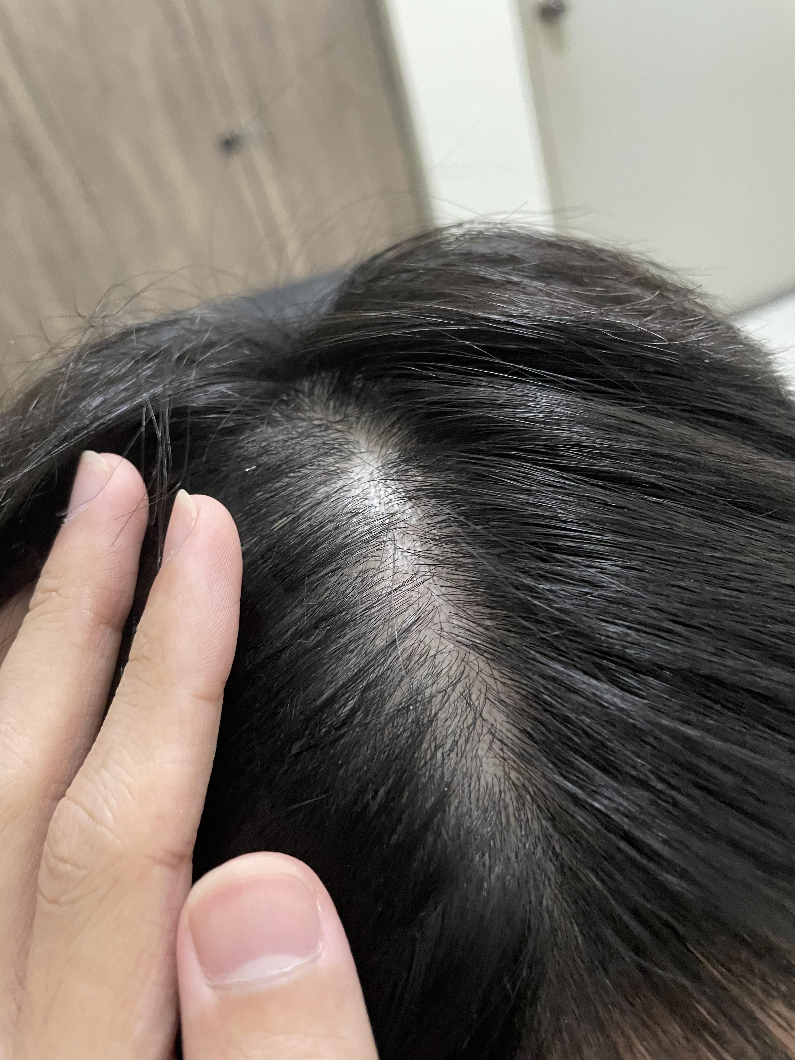 Why does my scalp looks so shiny and oily. Its even worse in person