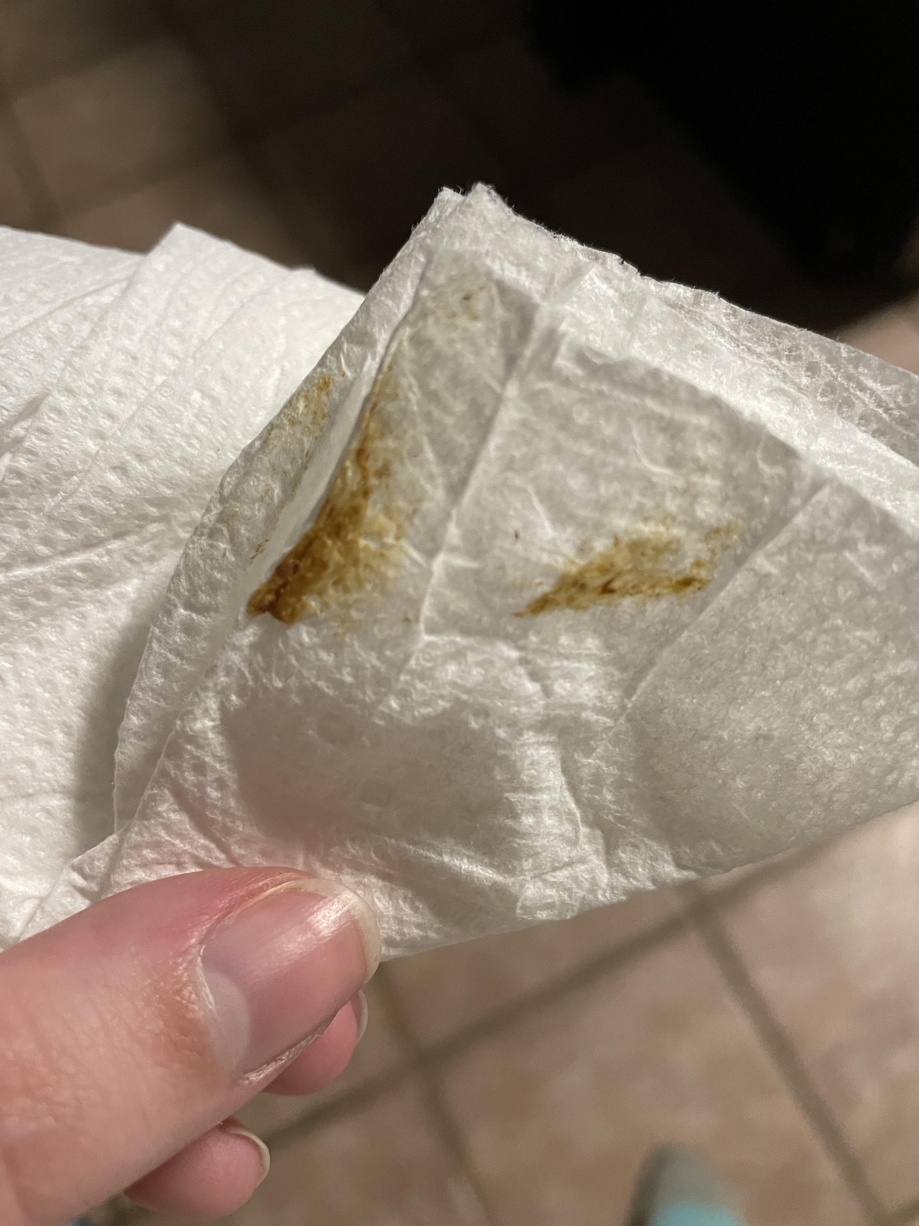 Is this a normal color after you wipe? r/poop