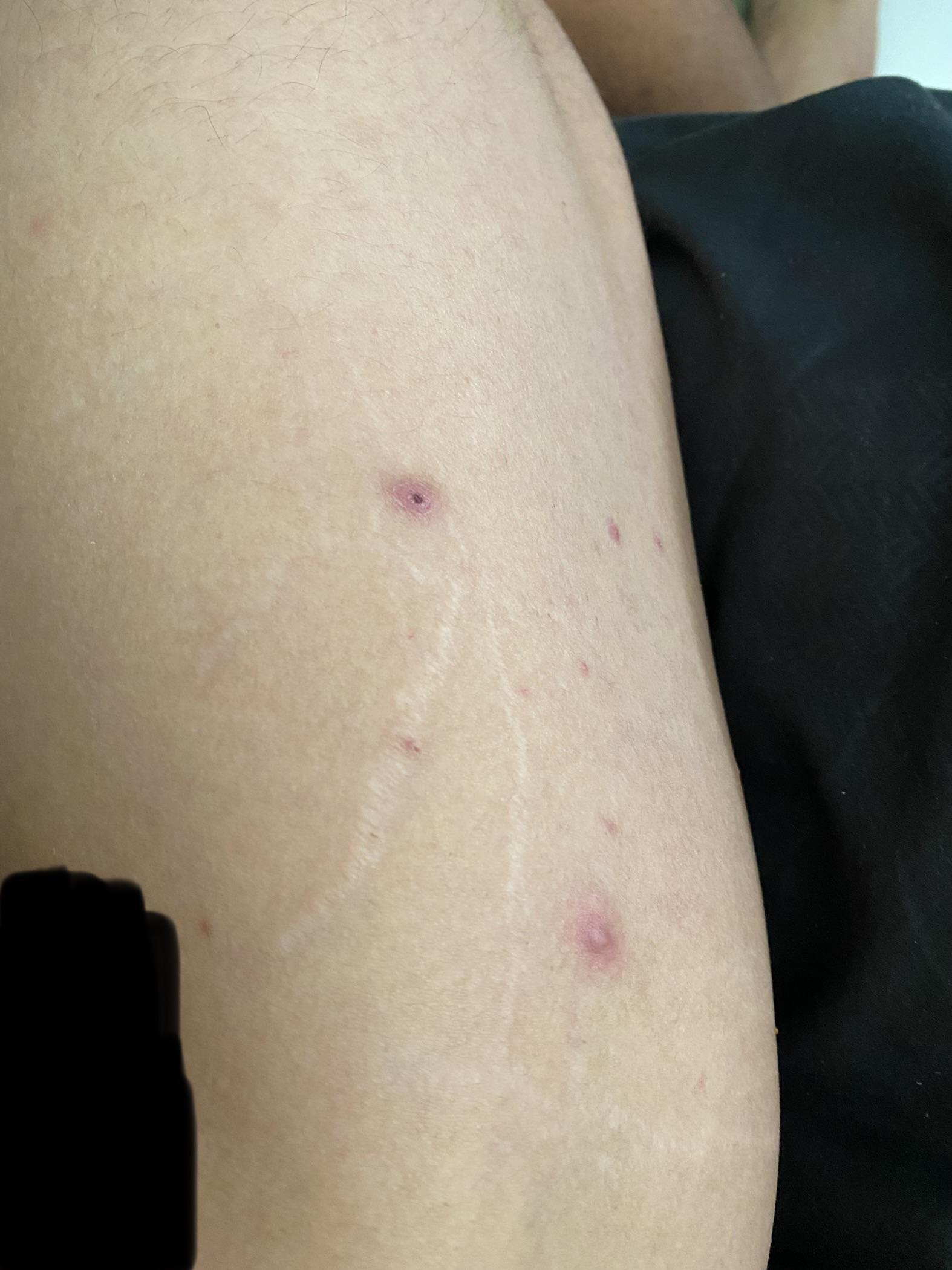 Does anyone know what this could be? Dark red/black bump and another