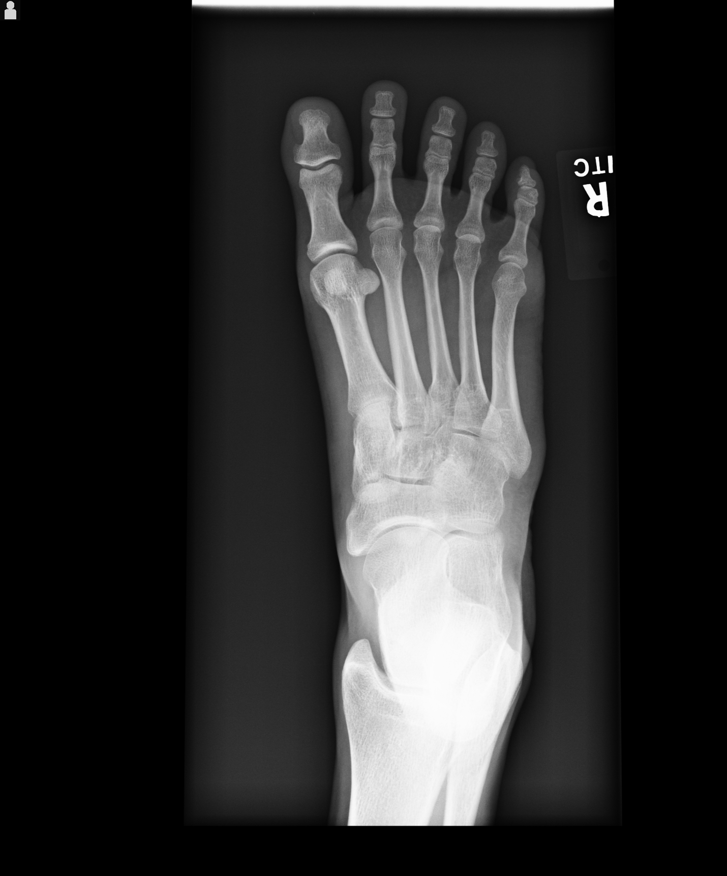 Why Do Feet Hurt At Night at Valentine Morrissey blog