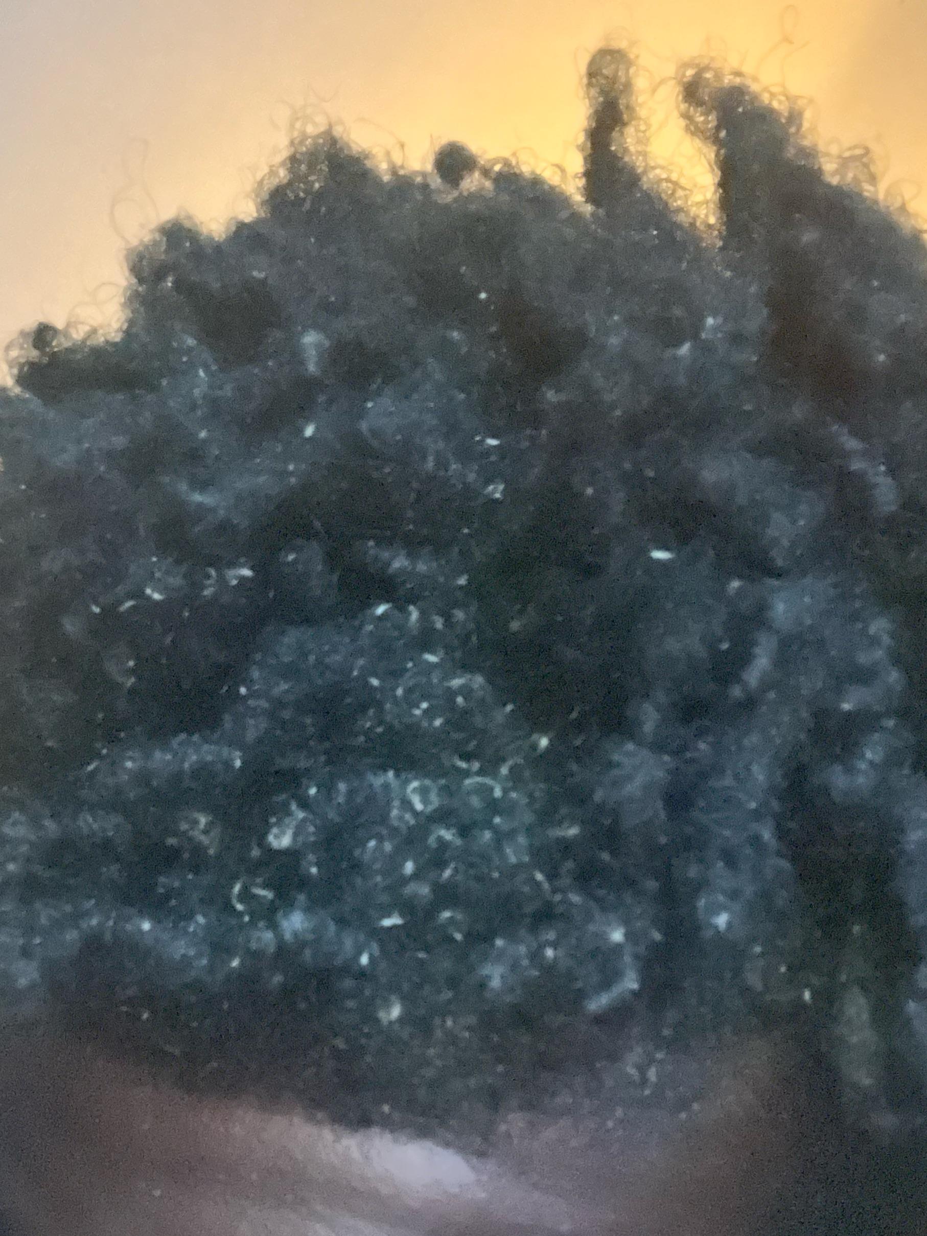 people say it looks like dust in my hair this is a day after washing