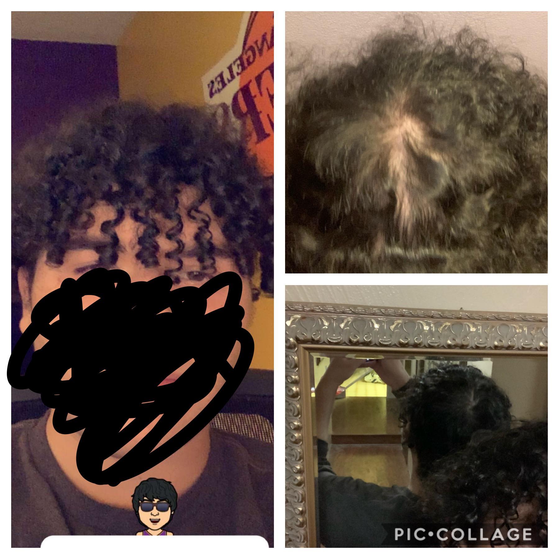 Am I balding? The bottom right is my hair wet and the top right is it