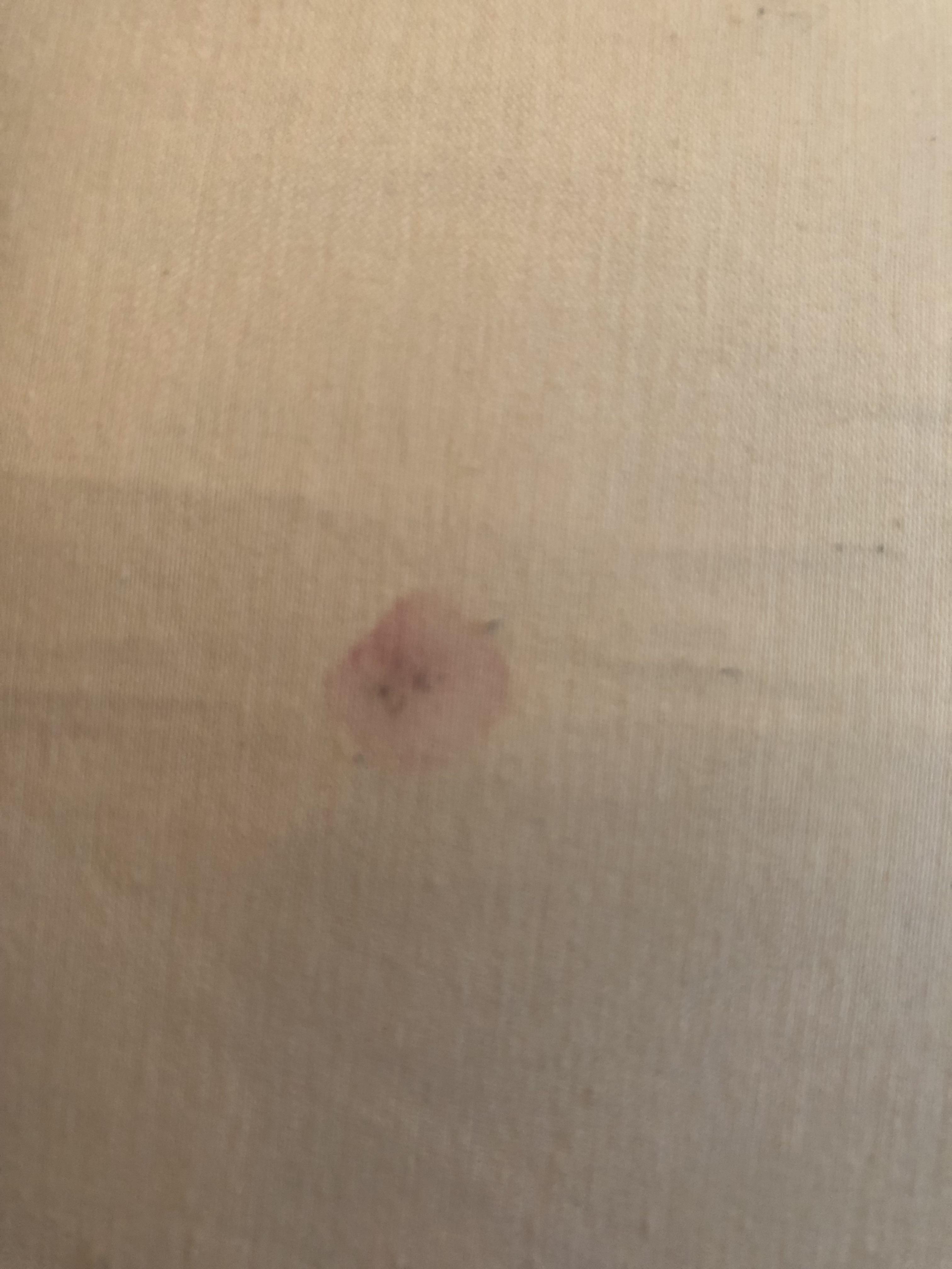 I woke up one morning and removed my pillow cover. Saw this random pink