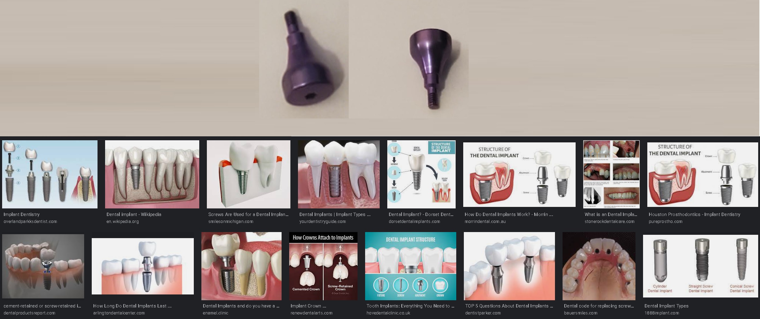 Please Help! My Newly Installed Dental Implant Screw Just Fell Out