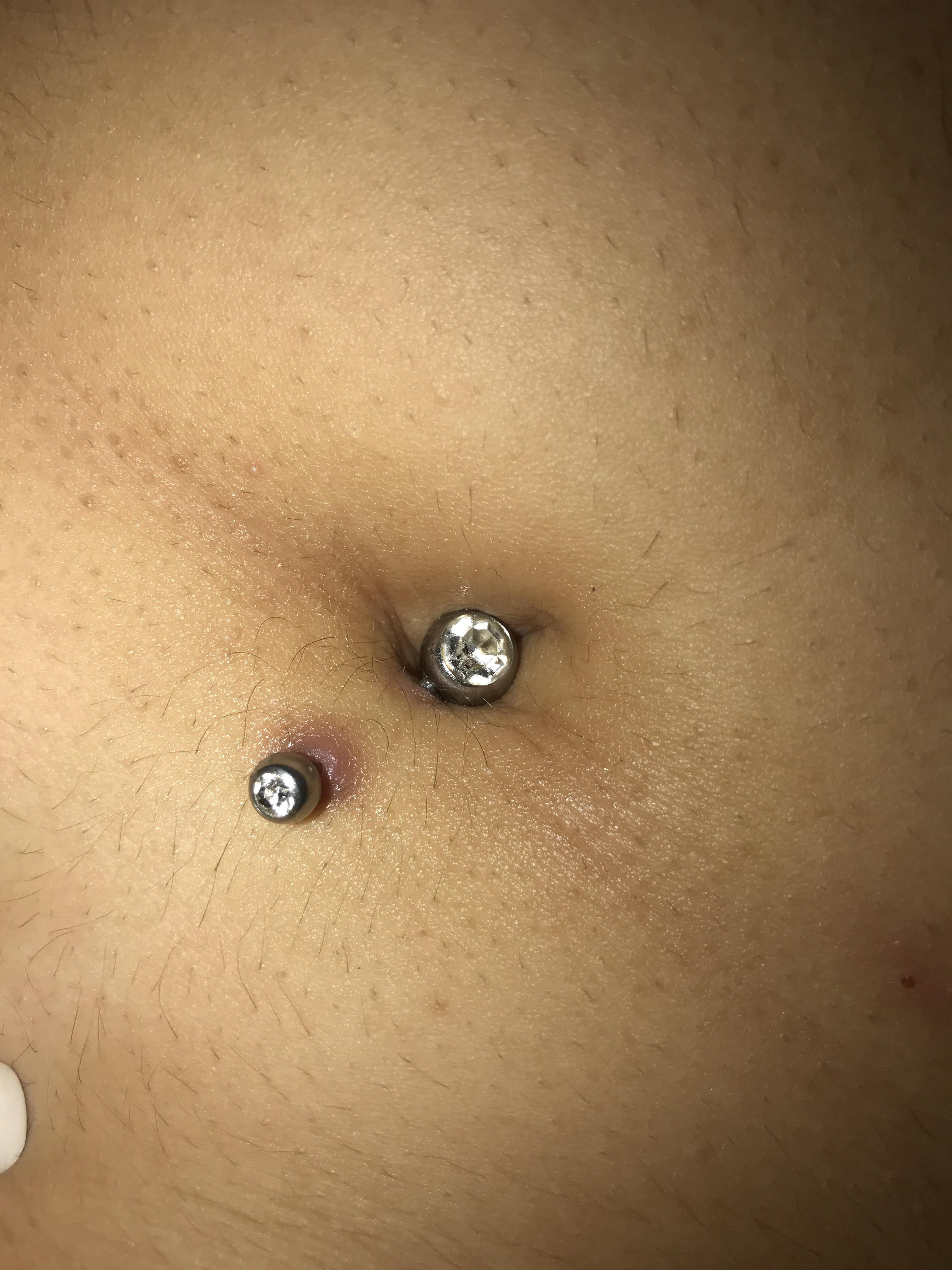 Is my belly button piercing rejecting? Is this normal