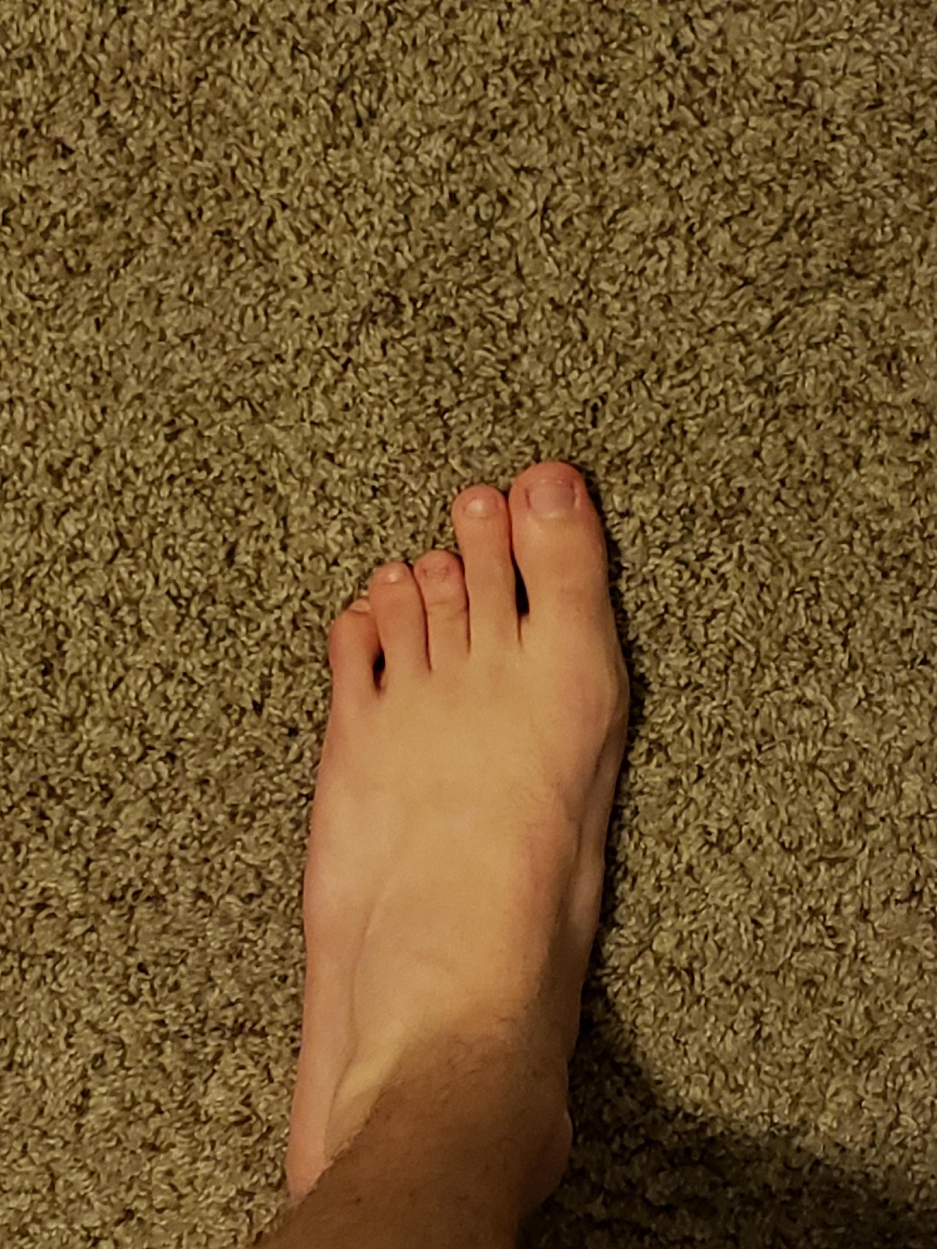 The short middle toe on my left foot r/mildlyinteresting