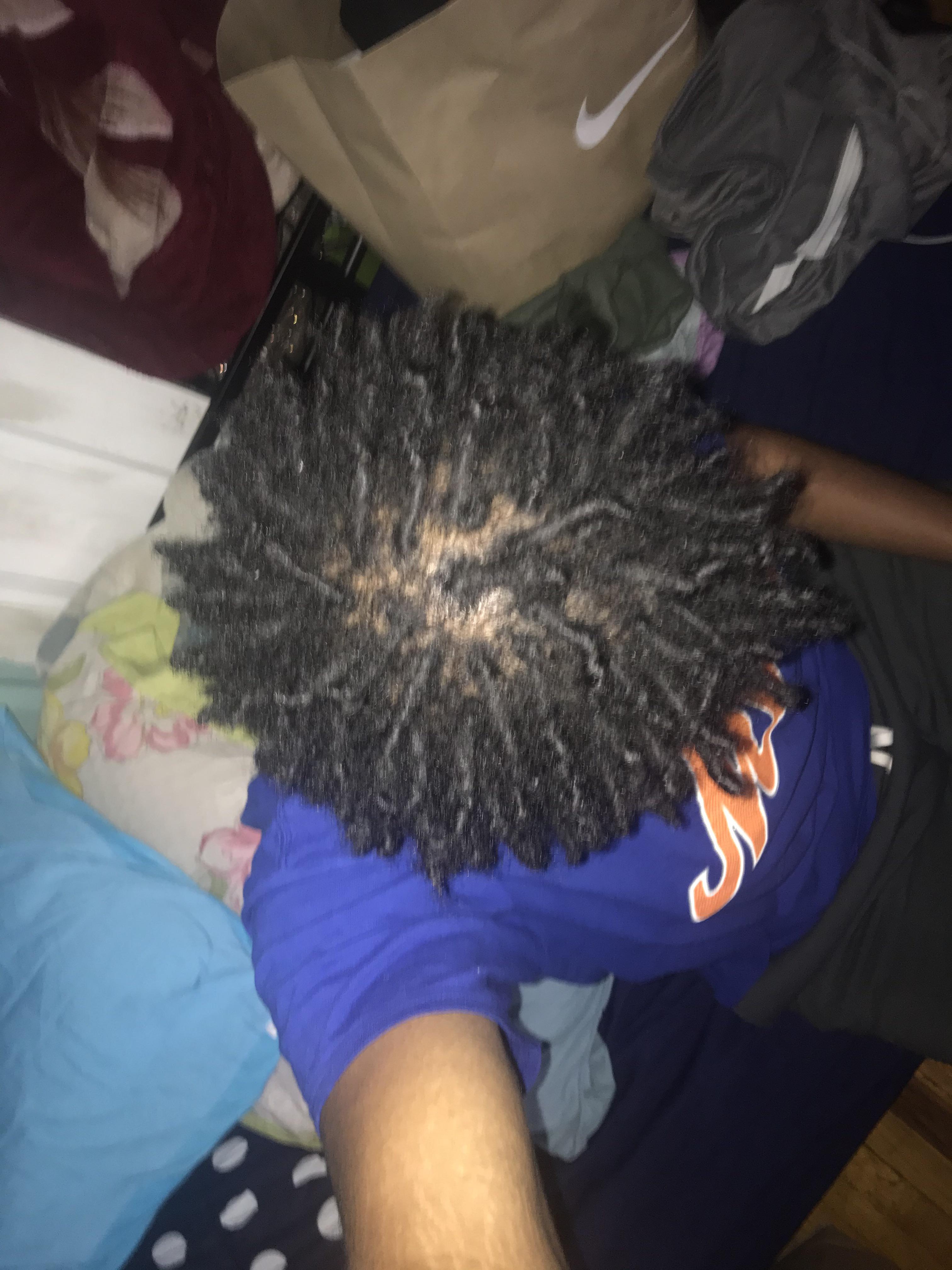 Is it normal for freeform dreads to do this or is my hair thinning ? It