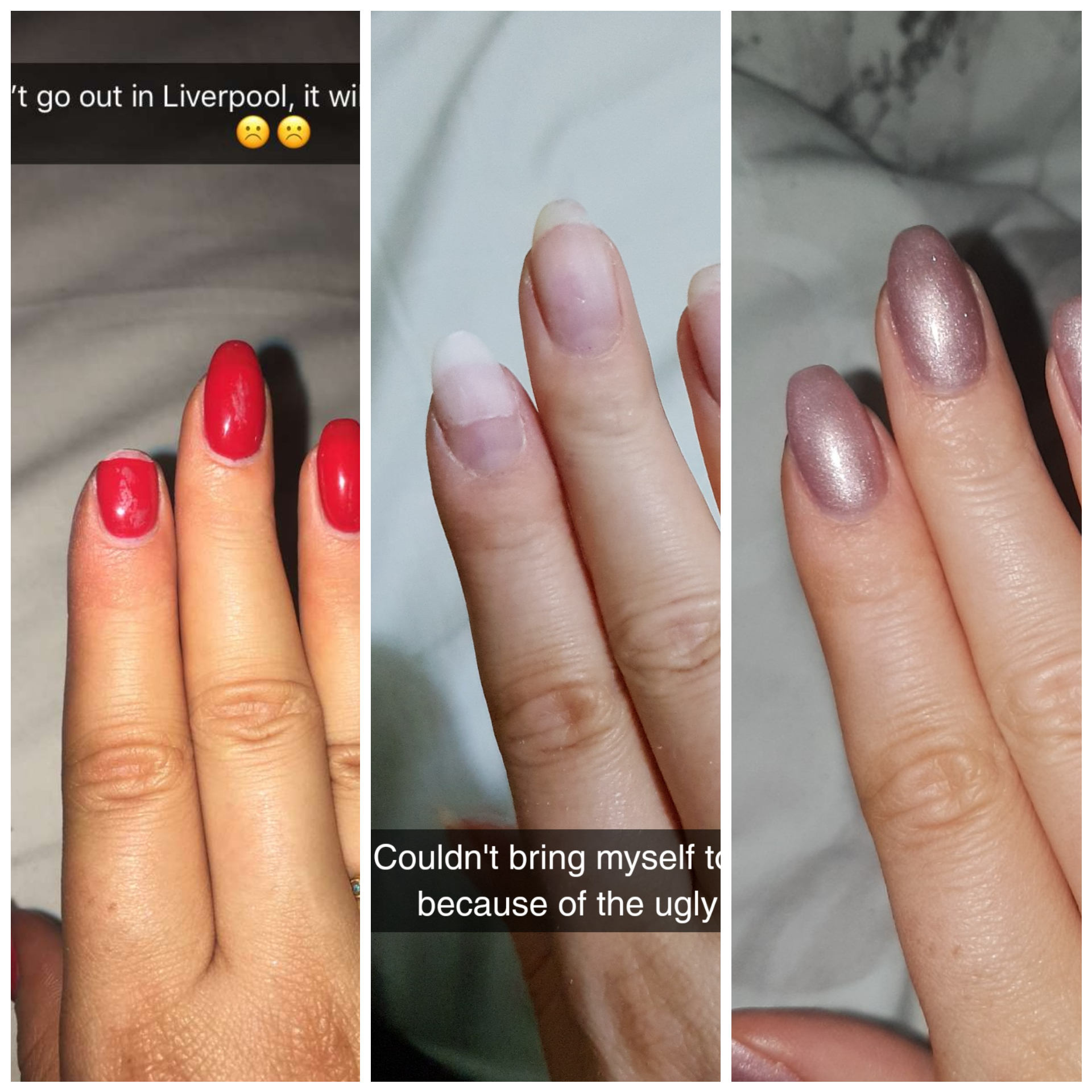 I performed life saving surgery on one of my nails yesterday r