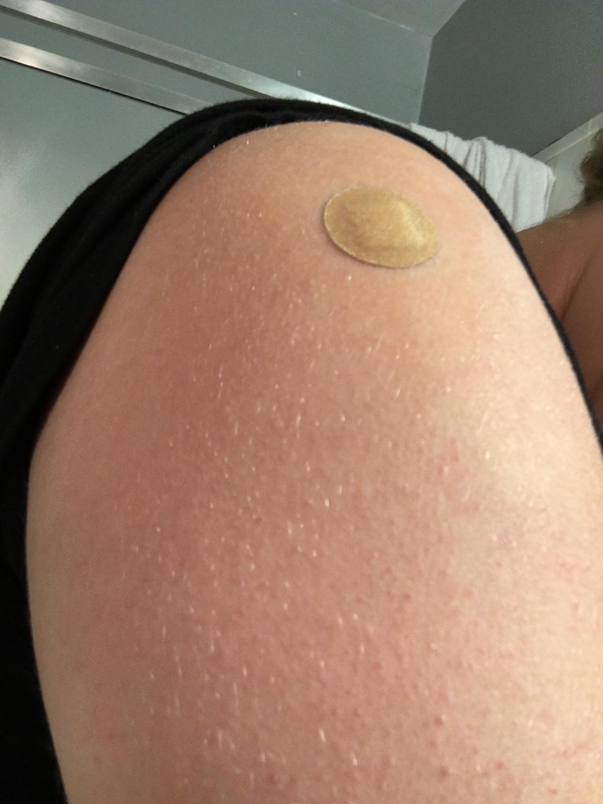 Finally got vaccinations for the first time since I was a