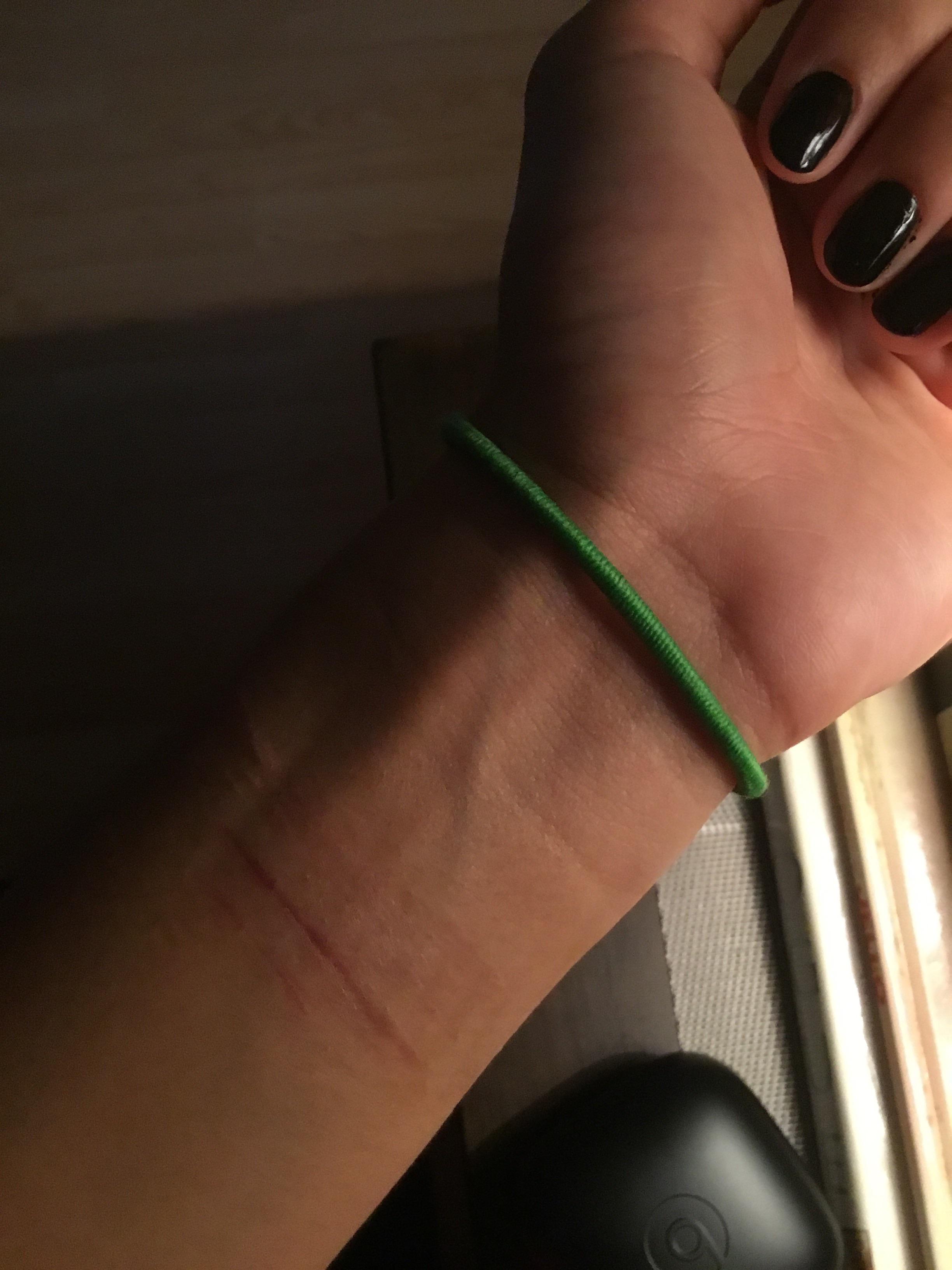 Had a stressful night so i kept snapping hair ties on my wrist, it made