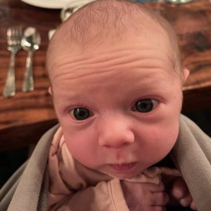 I have deep forehead wrinkles I want to get rid of to look like all the