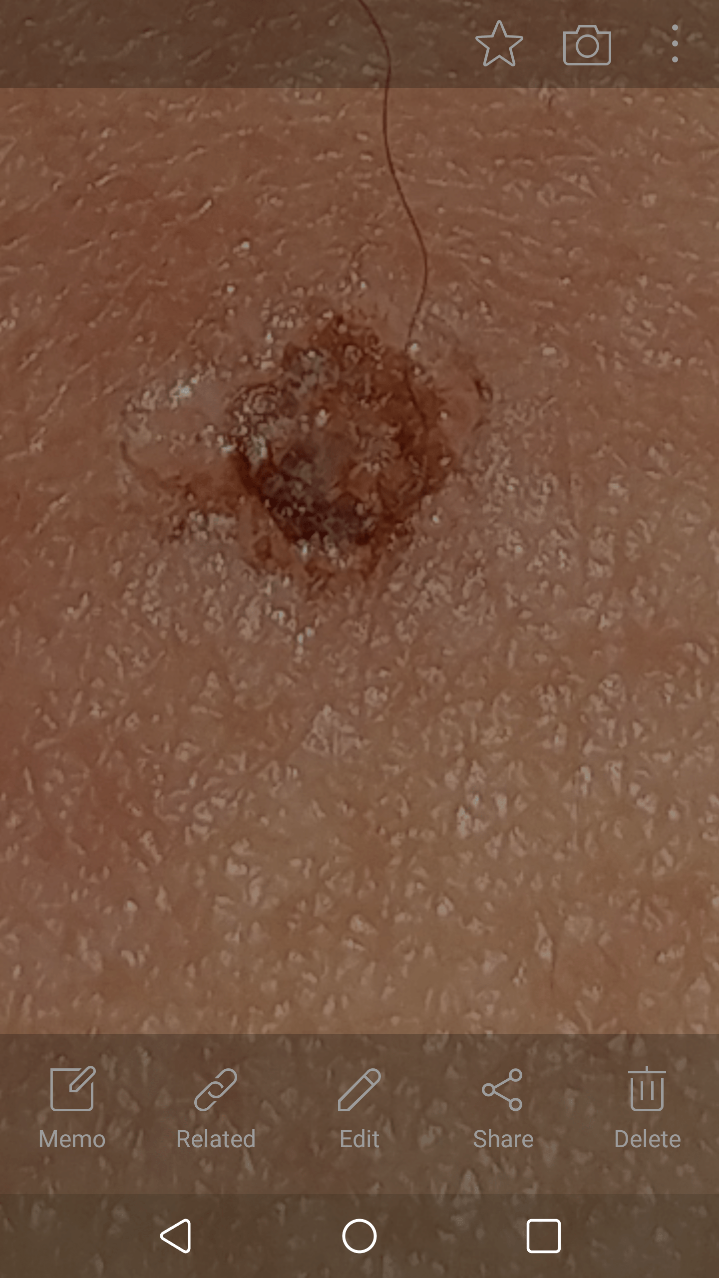 Should I get this looked at? It just appear like two weeks ago and has